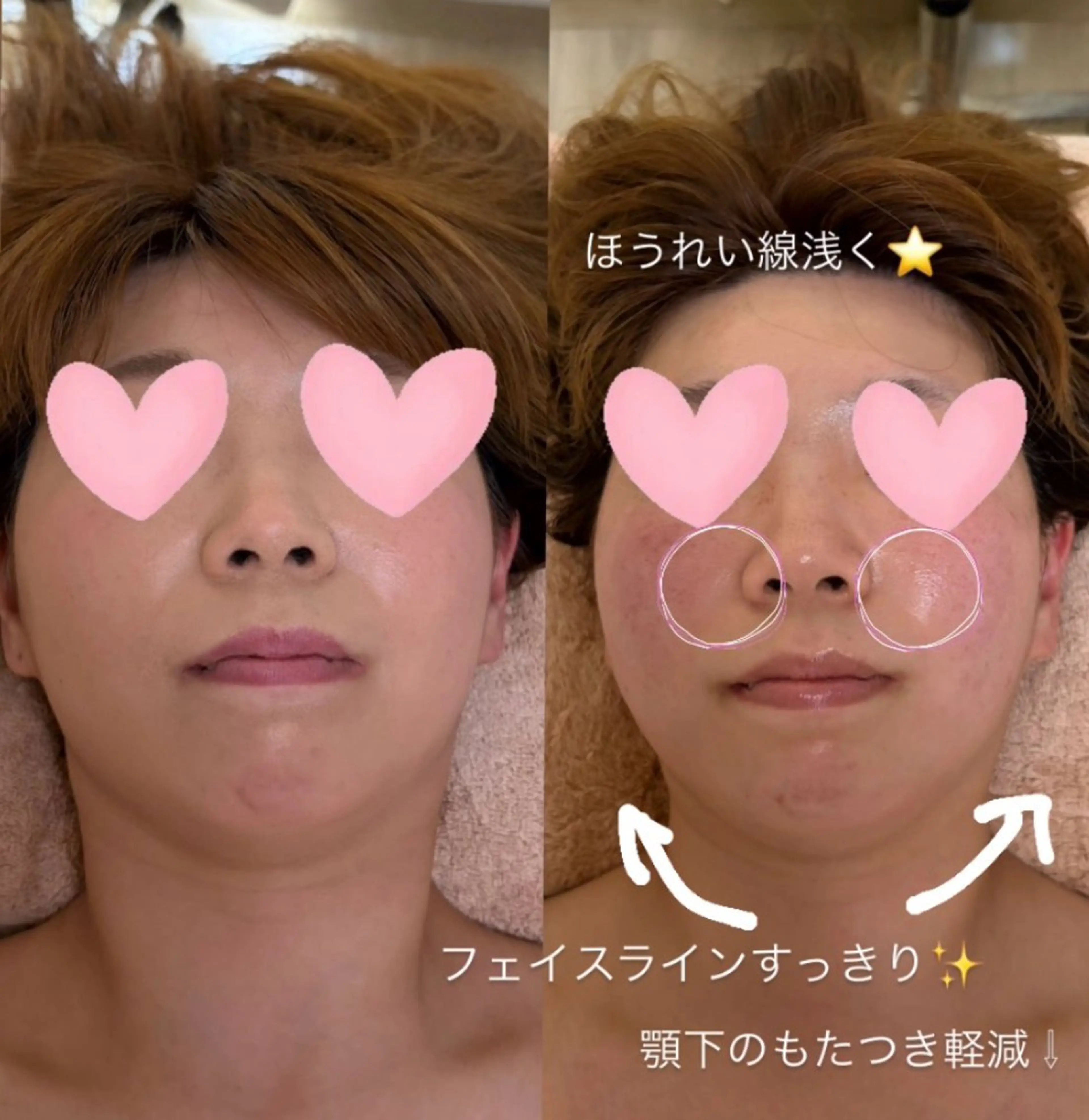 その他 Rin🎀 マユのその他イメージ