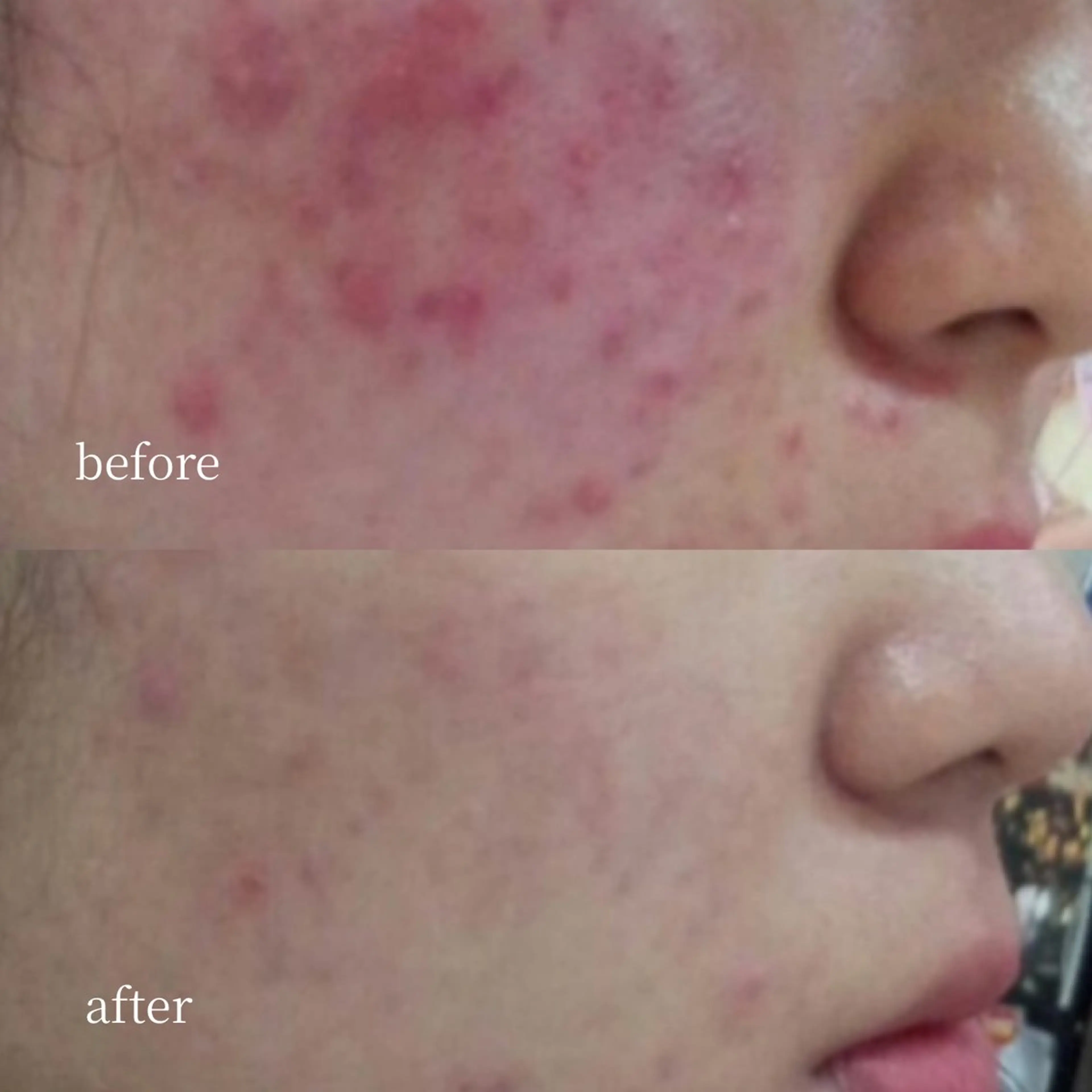 韓国肌管理・肌質改善 EARNEST心斎橋のエステ・リラクイメージ