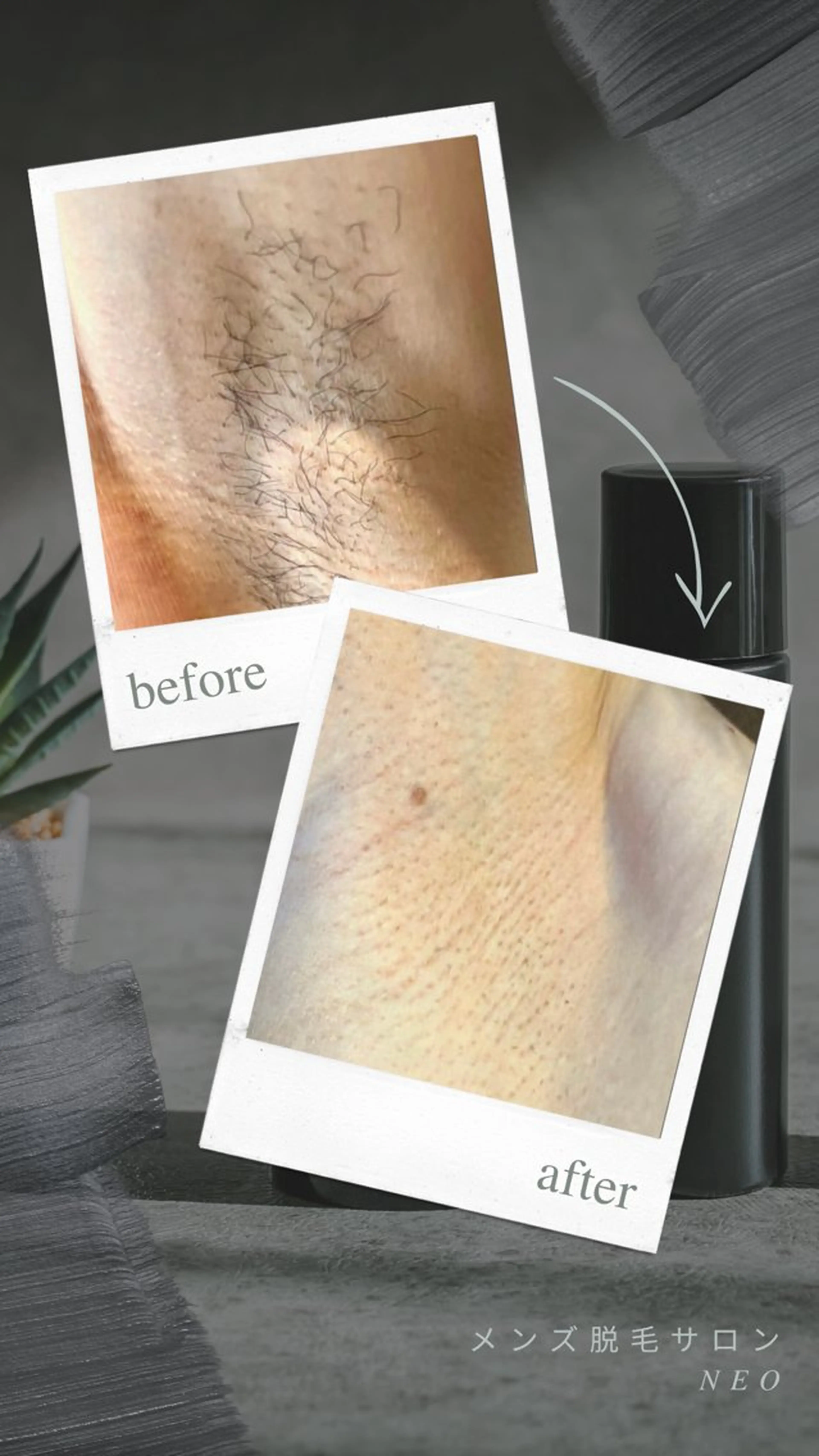 メンズ 脱毛 メンズ脱毛サロン NEOのエステ・リラクイメージ