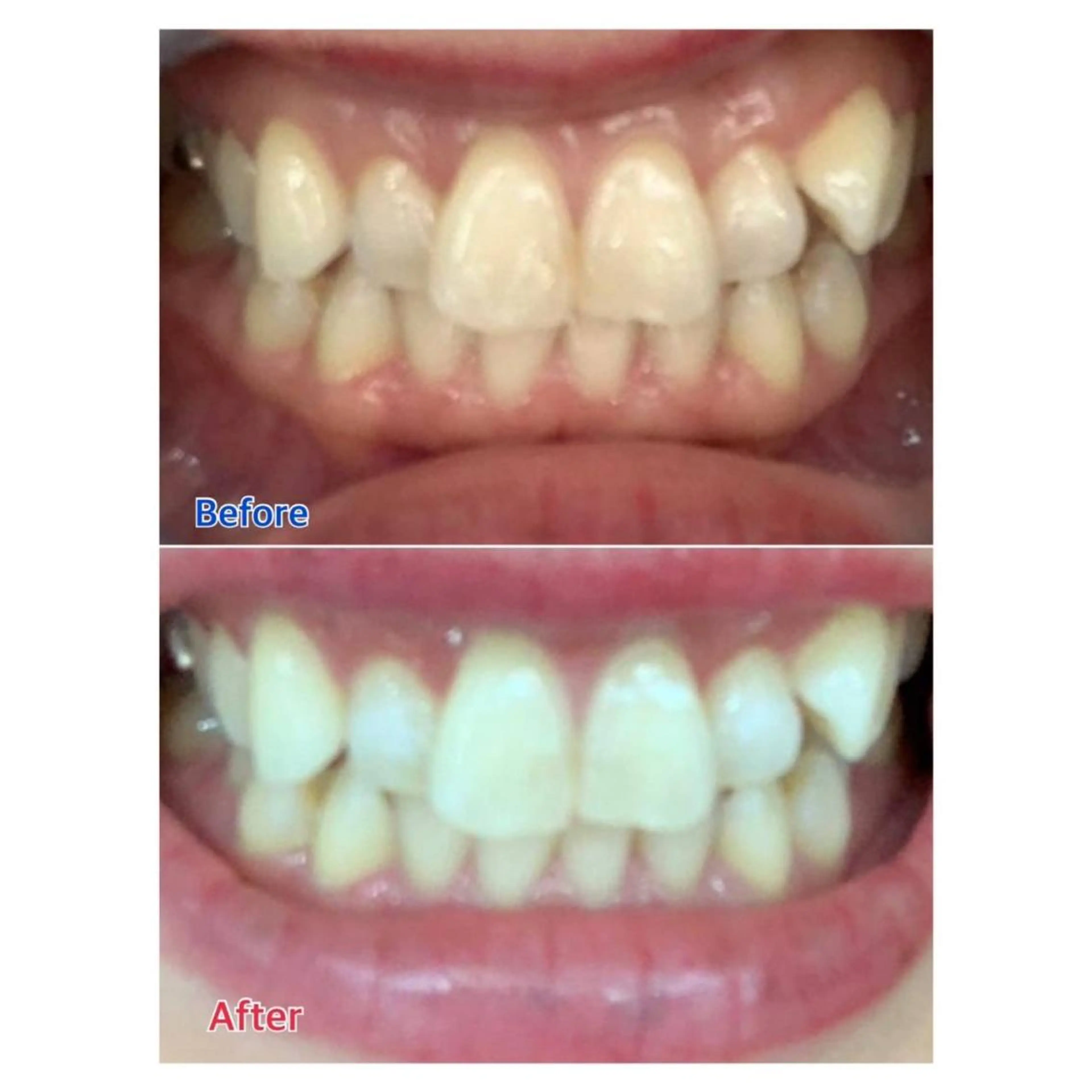 Melty 輝のその他イメージ