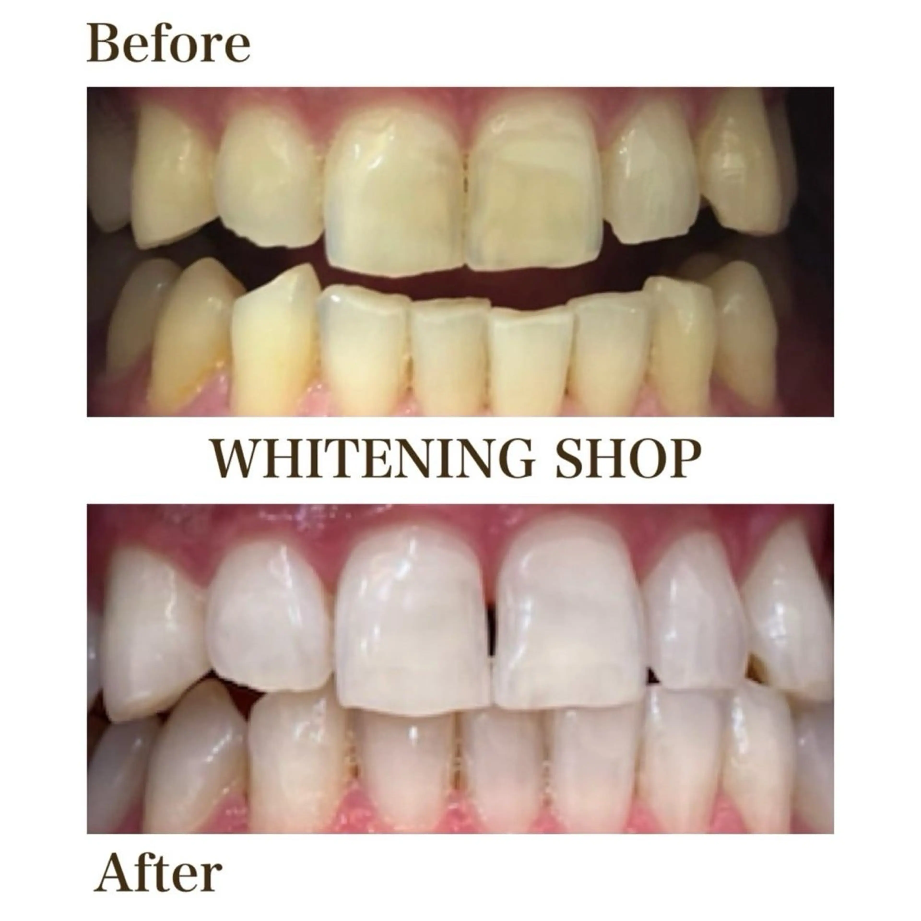 メンズ ホワイトニング専門店 10年の実績|樟葉駅のエステ・リラクイメージ