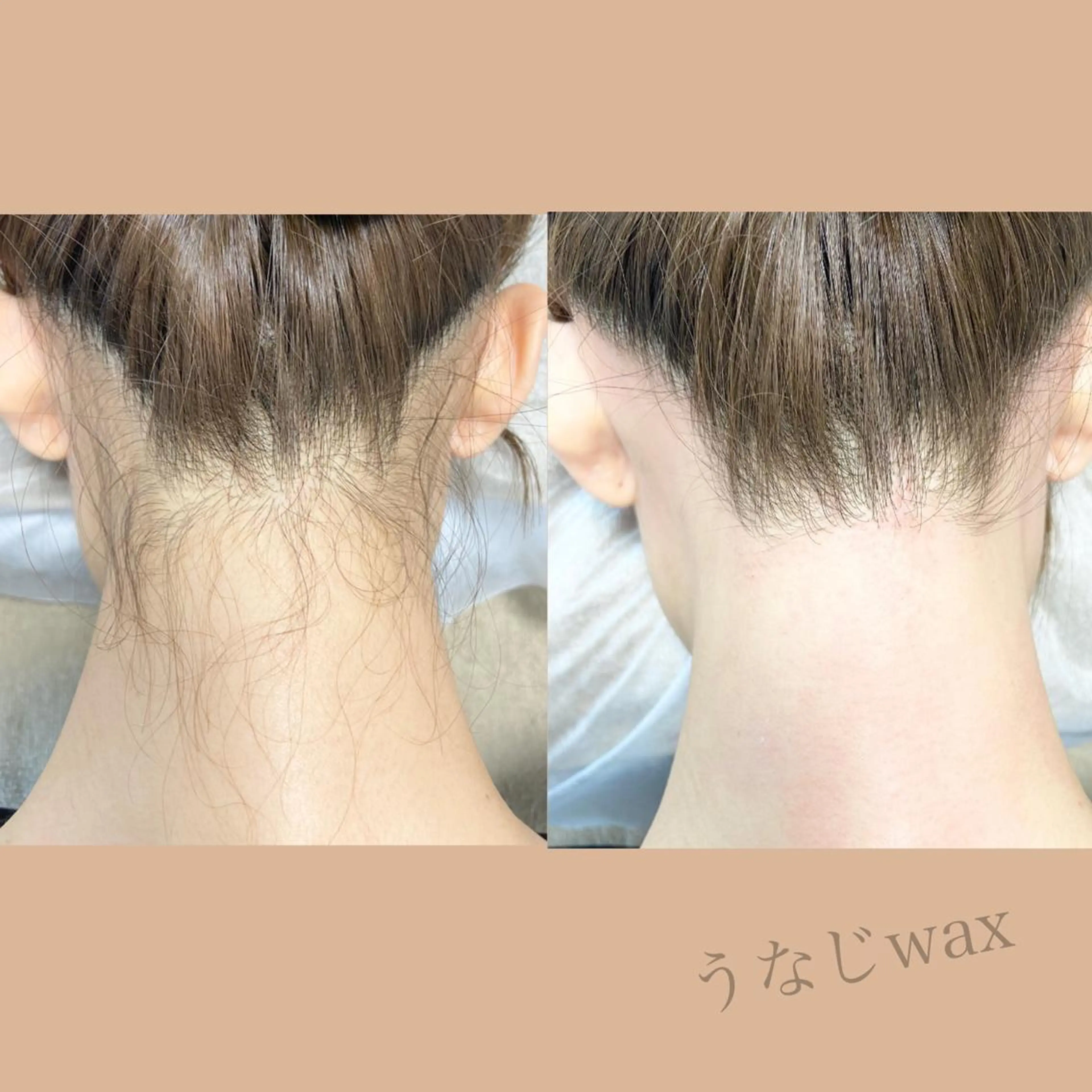 脱毛 &me ayakaのエステ・リラクイメージ
