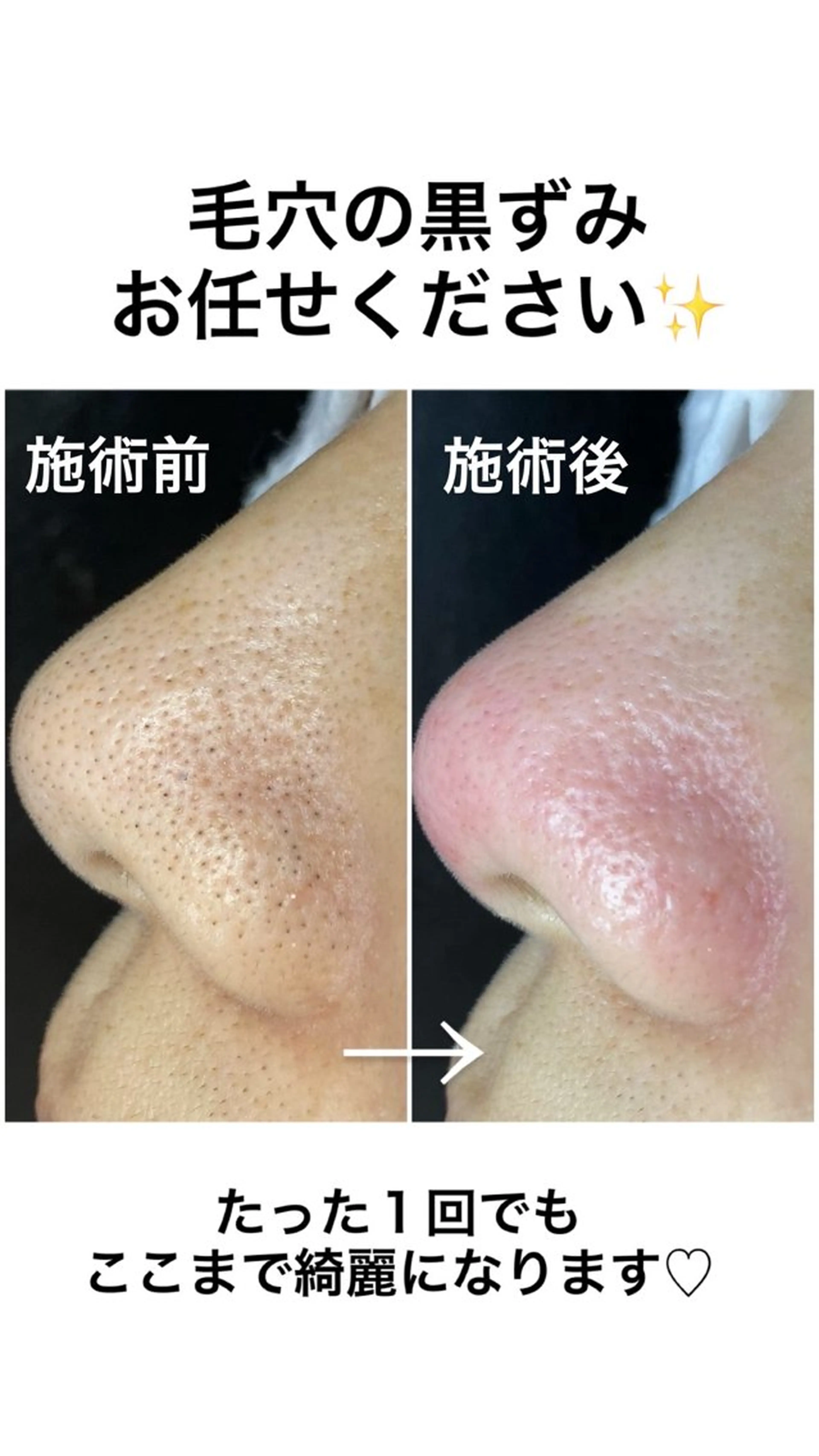 エステ 毛穴専門店【各務原】 天使の毛穴のエステ・リラクイメージ