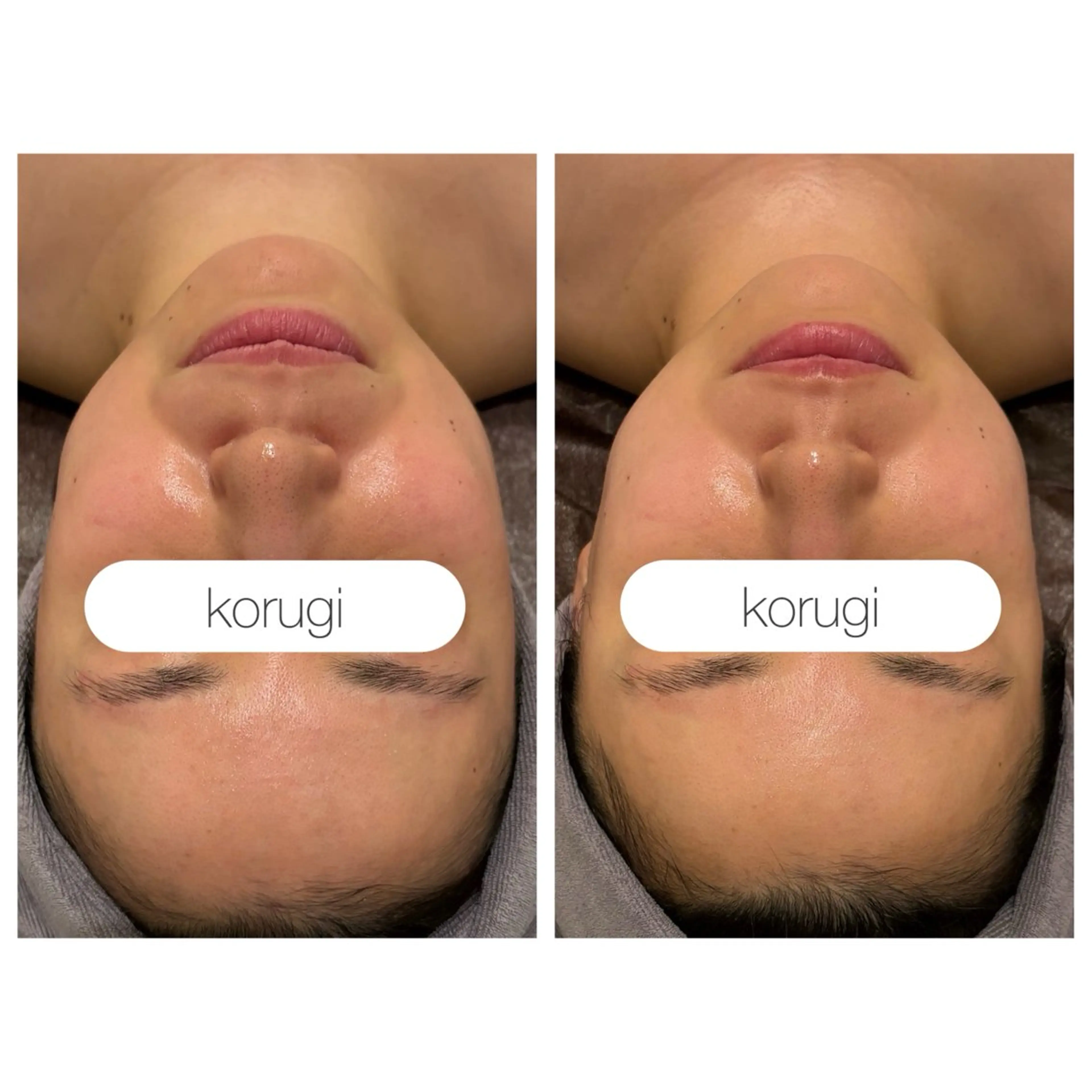 小顔コルギ ☆表参道/外苑前のエステ・リラクイメージ