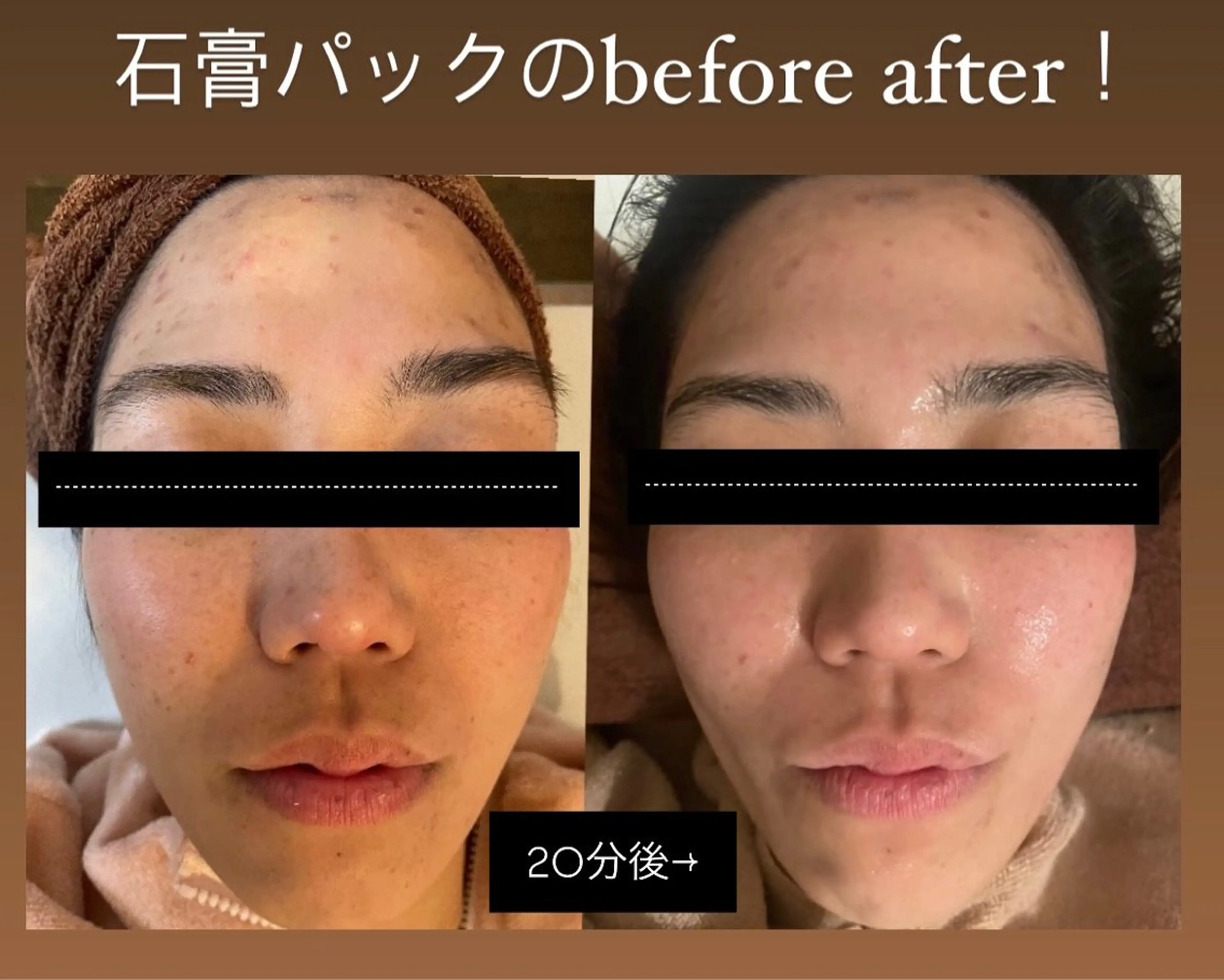 脱毛 脱毛🌈Beauty Salon新宿店のエステ・リラクイメージ