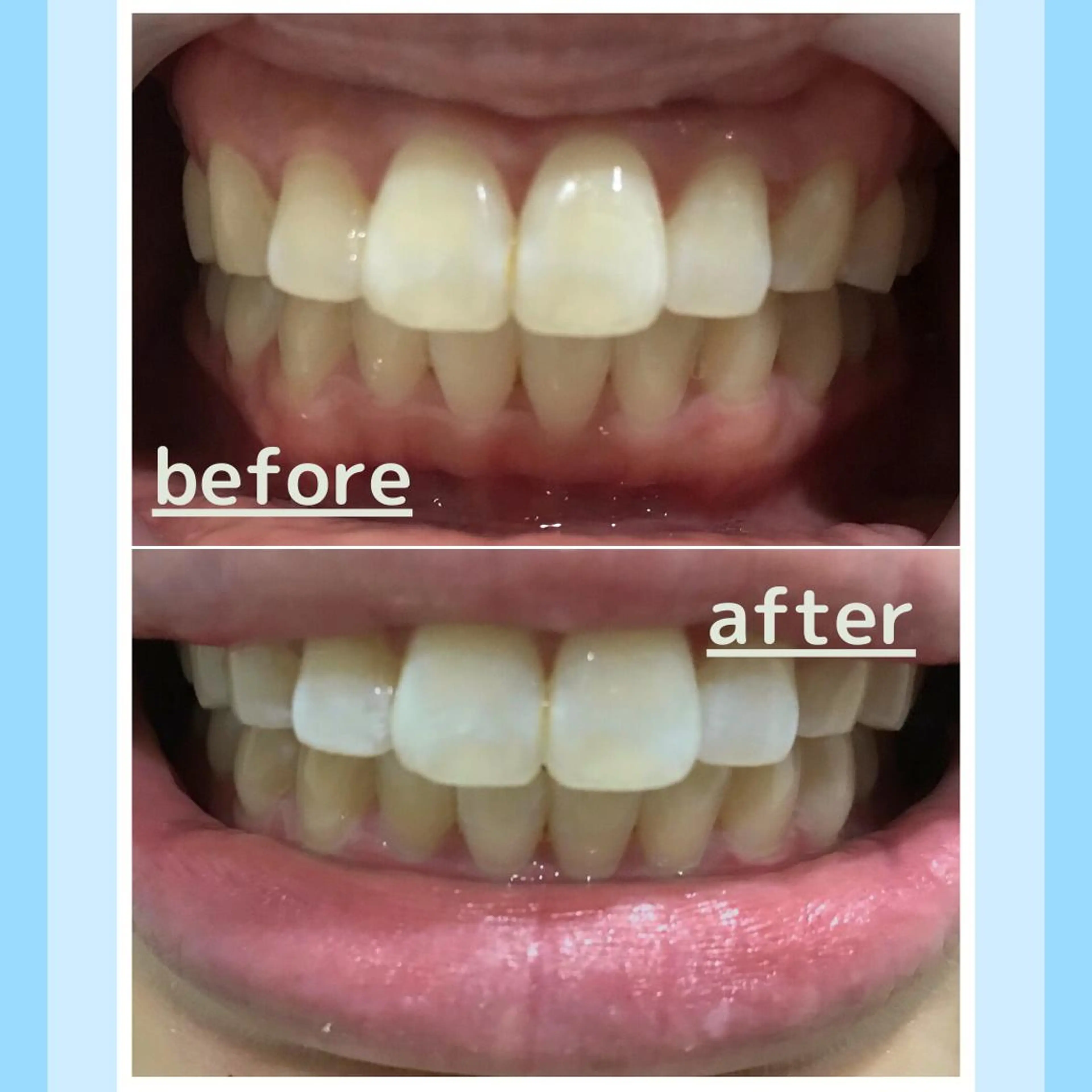 メンズ お手軽ホワイトニングsalon mina所属・武元 奈津美のその他イメージ