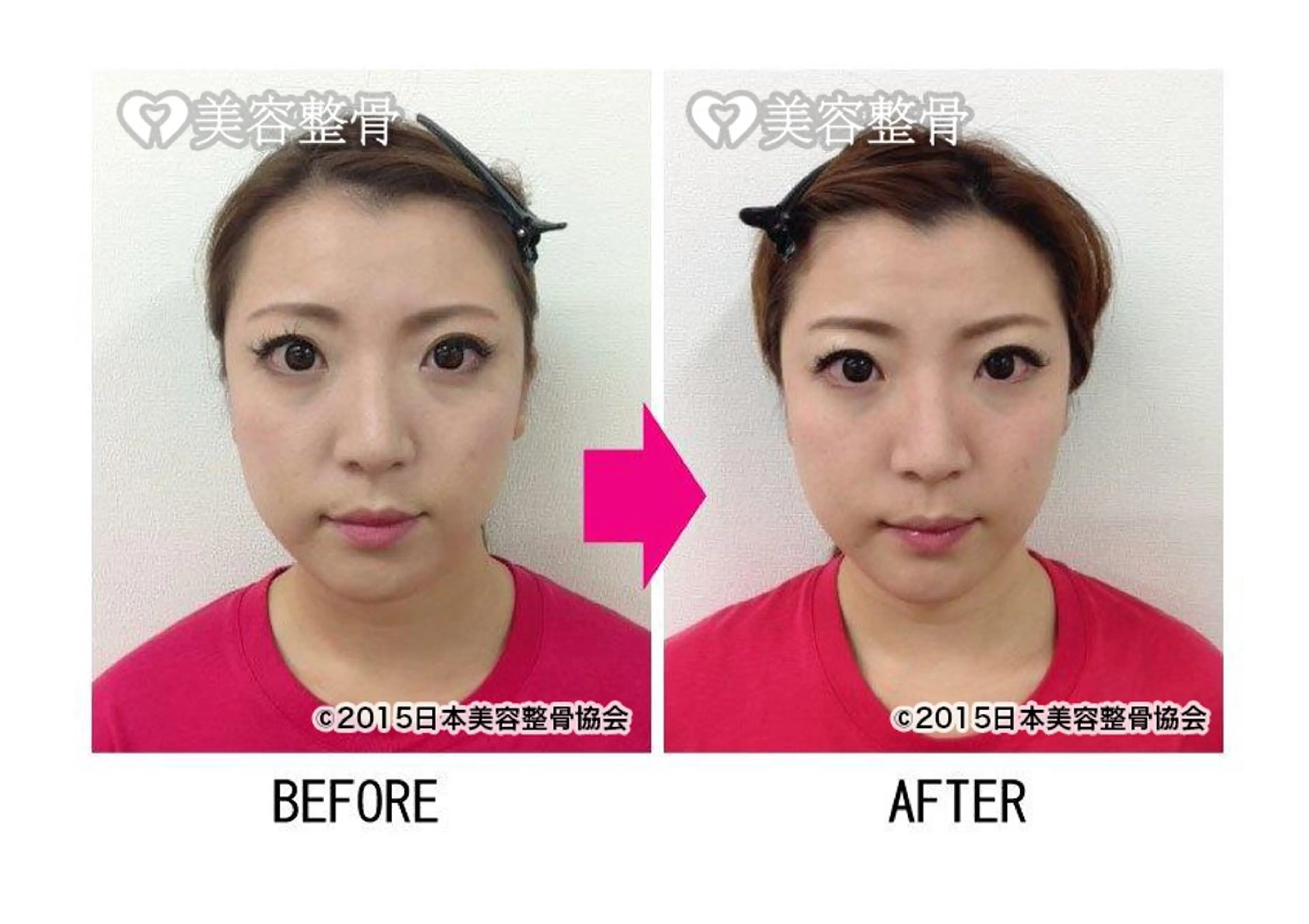 その他 上野 伊久美のその他イメージ