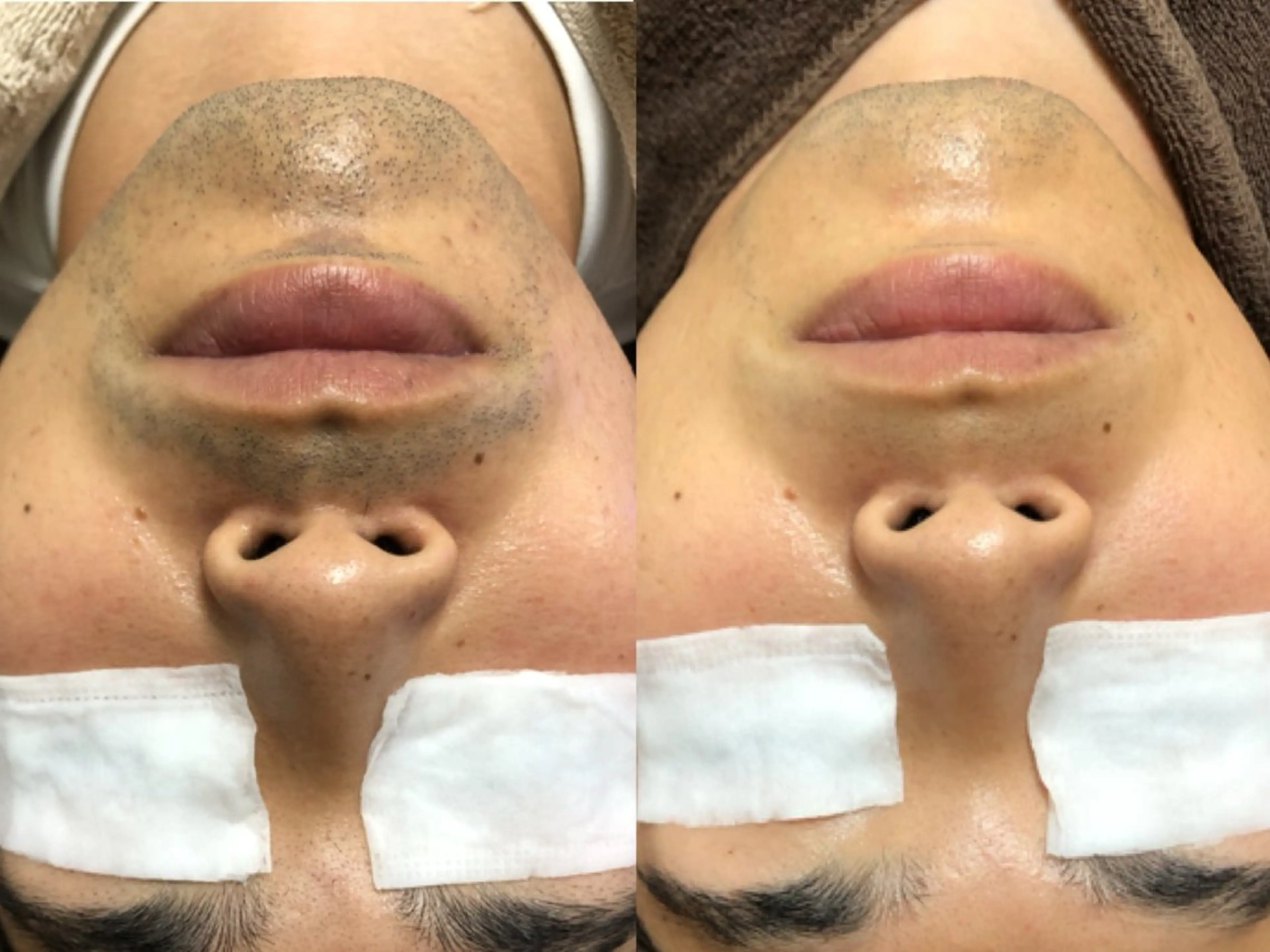 LANA所属・エステサロン LANA.のエステ・リラクイメージ