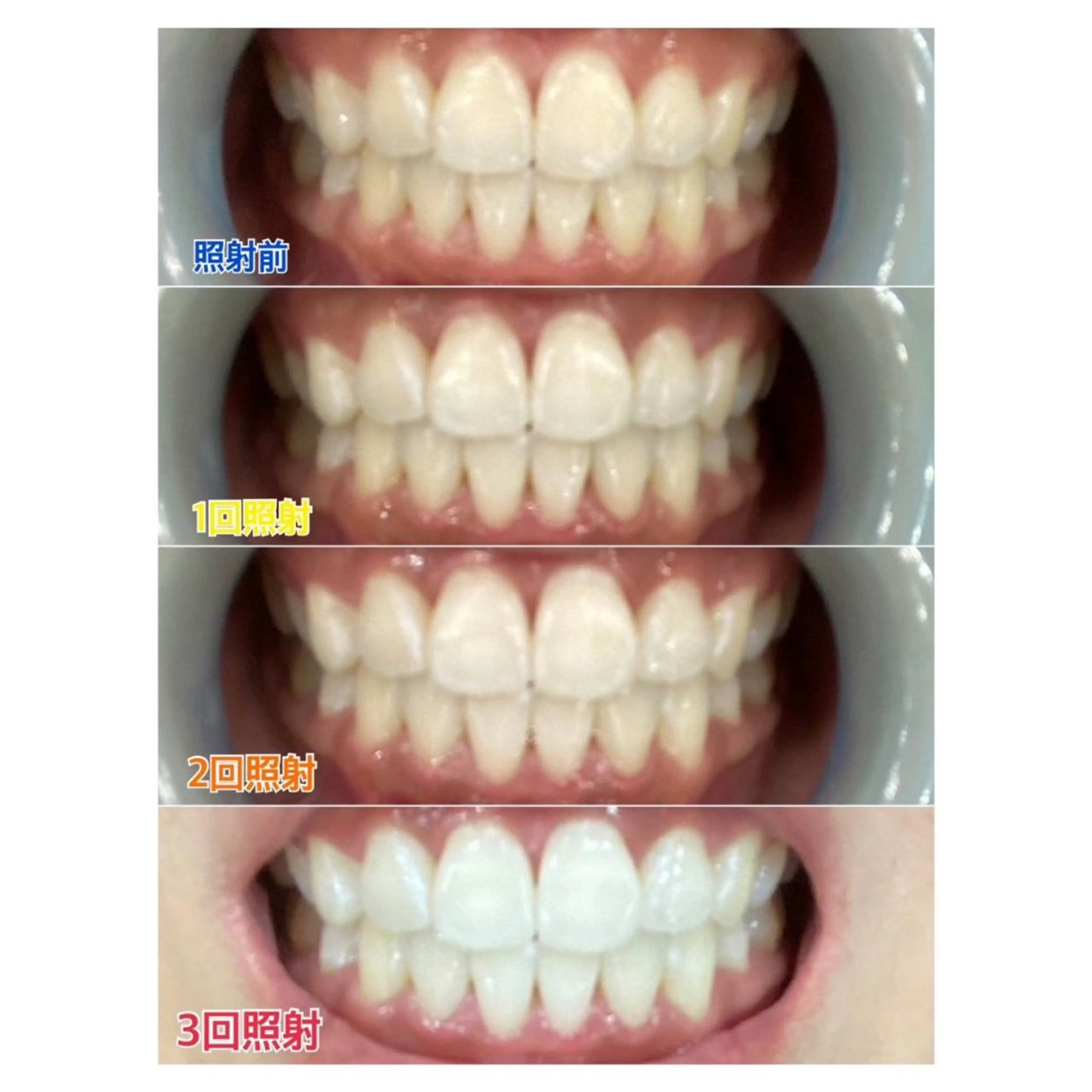 MBEAUTYSALON 千葉店・京成大久保所属・Melty 輝のその他イメージ