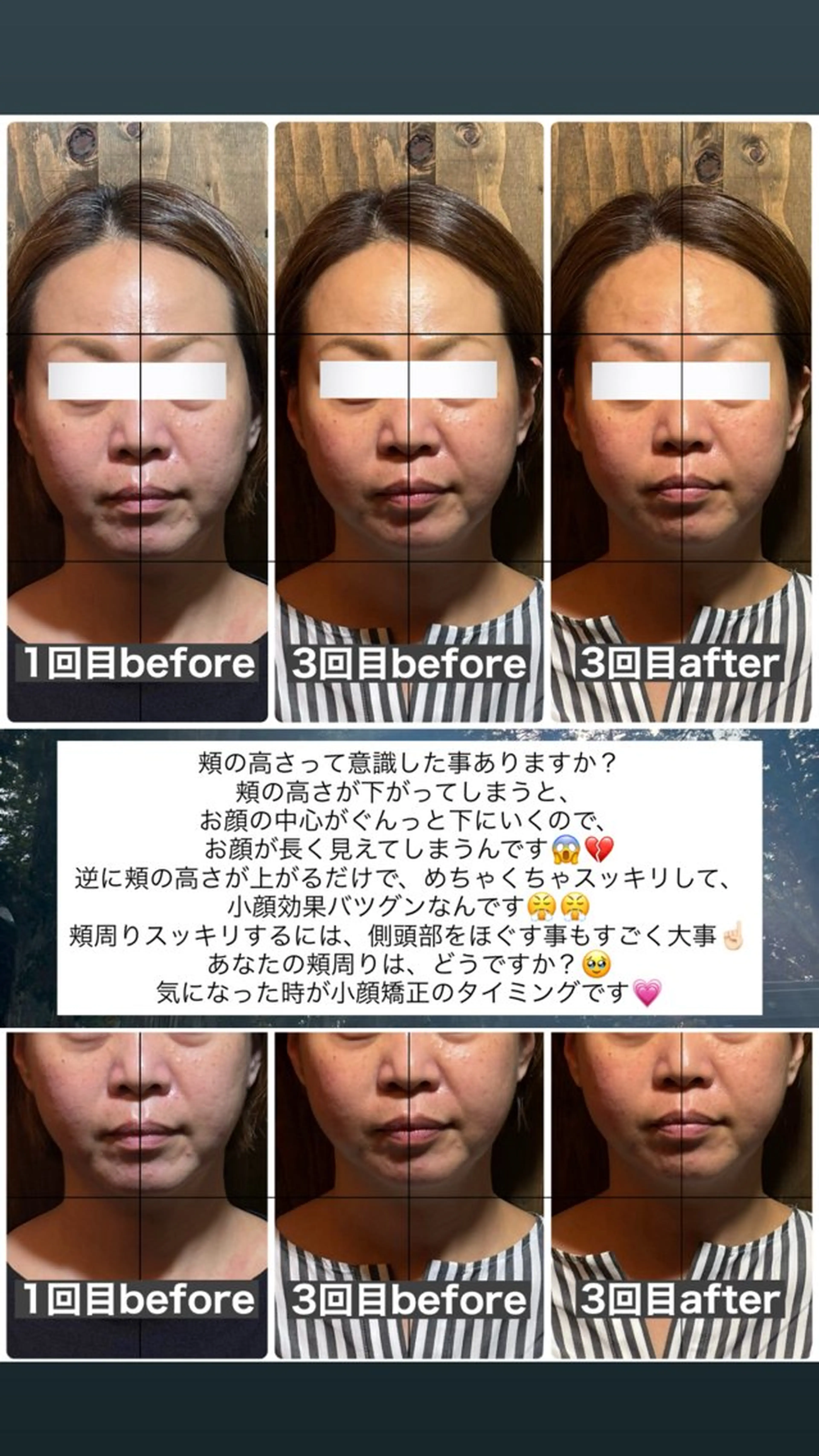 エステ リラク 💎後悔させない小顔 矯正💎イトヤマ🌱のエステ・リラクイメージ