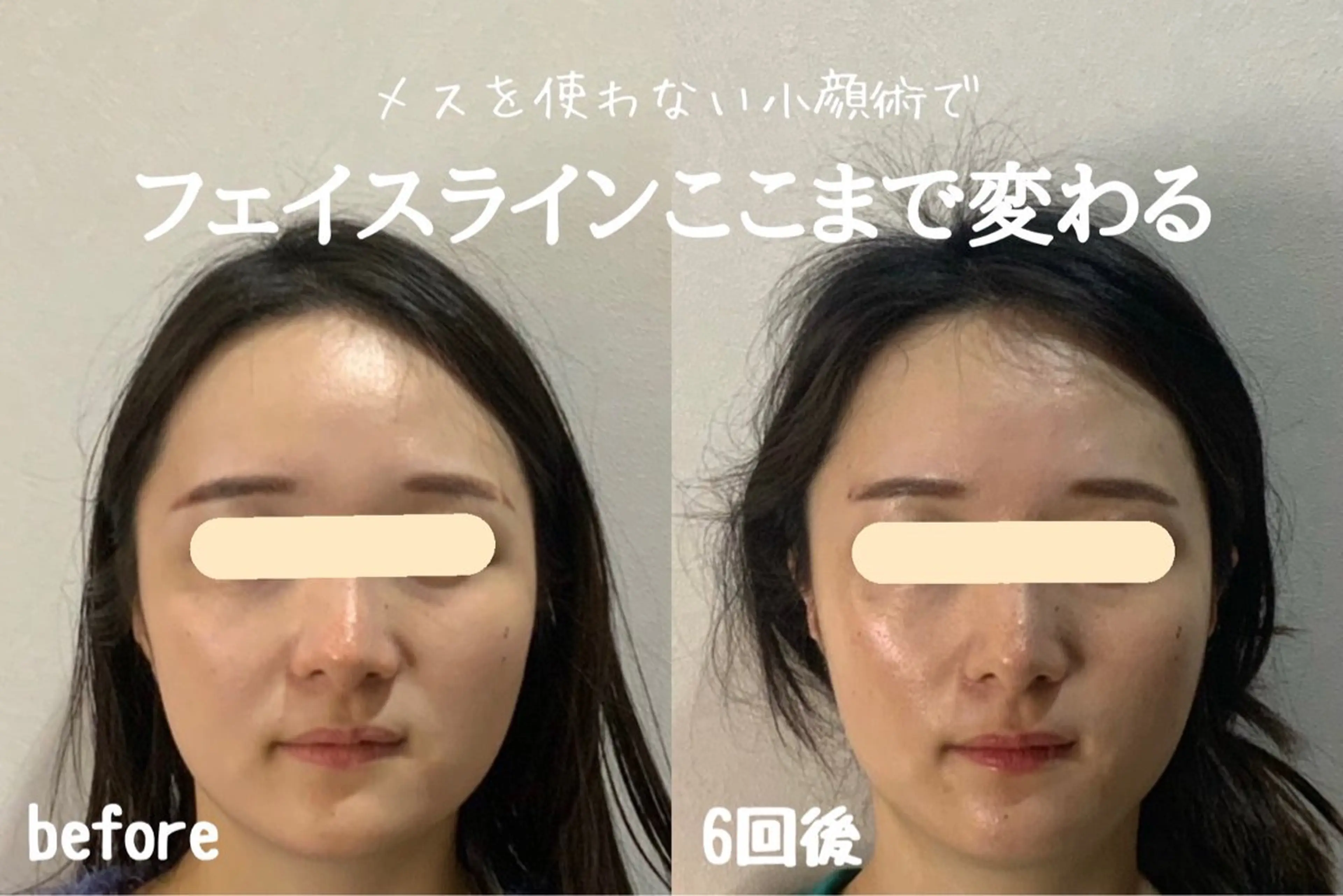 エステ リラク 最速小顔・肌質管理 espoirマキのエステ・リラクイメージ
