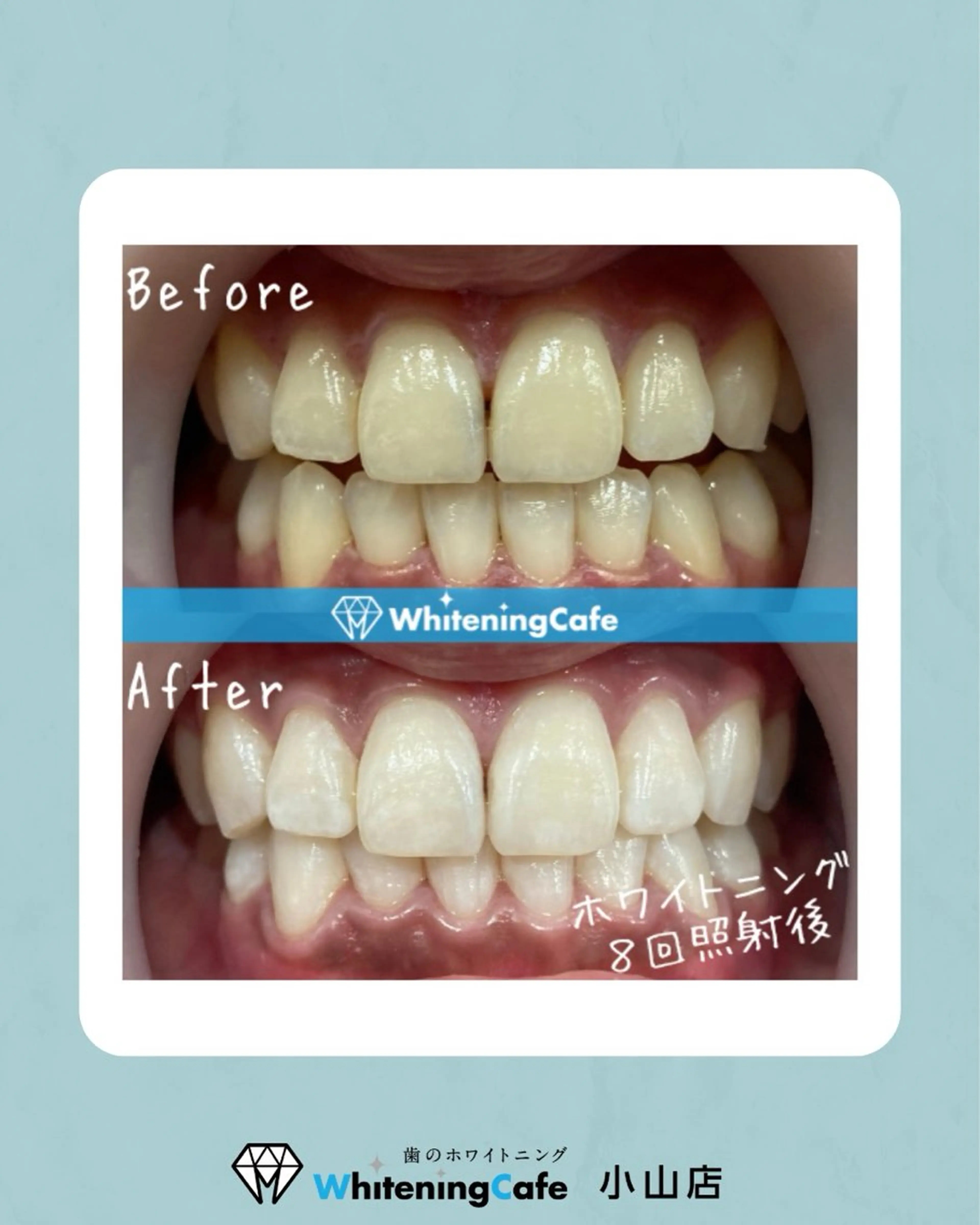 ホワイトニングカフェ 小山店のエステ・リラクイメージ