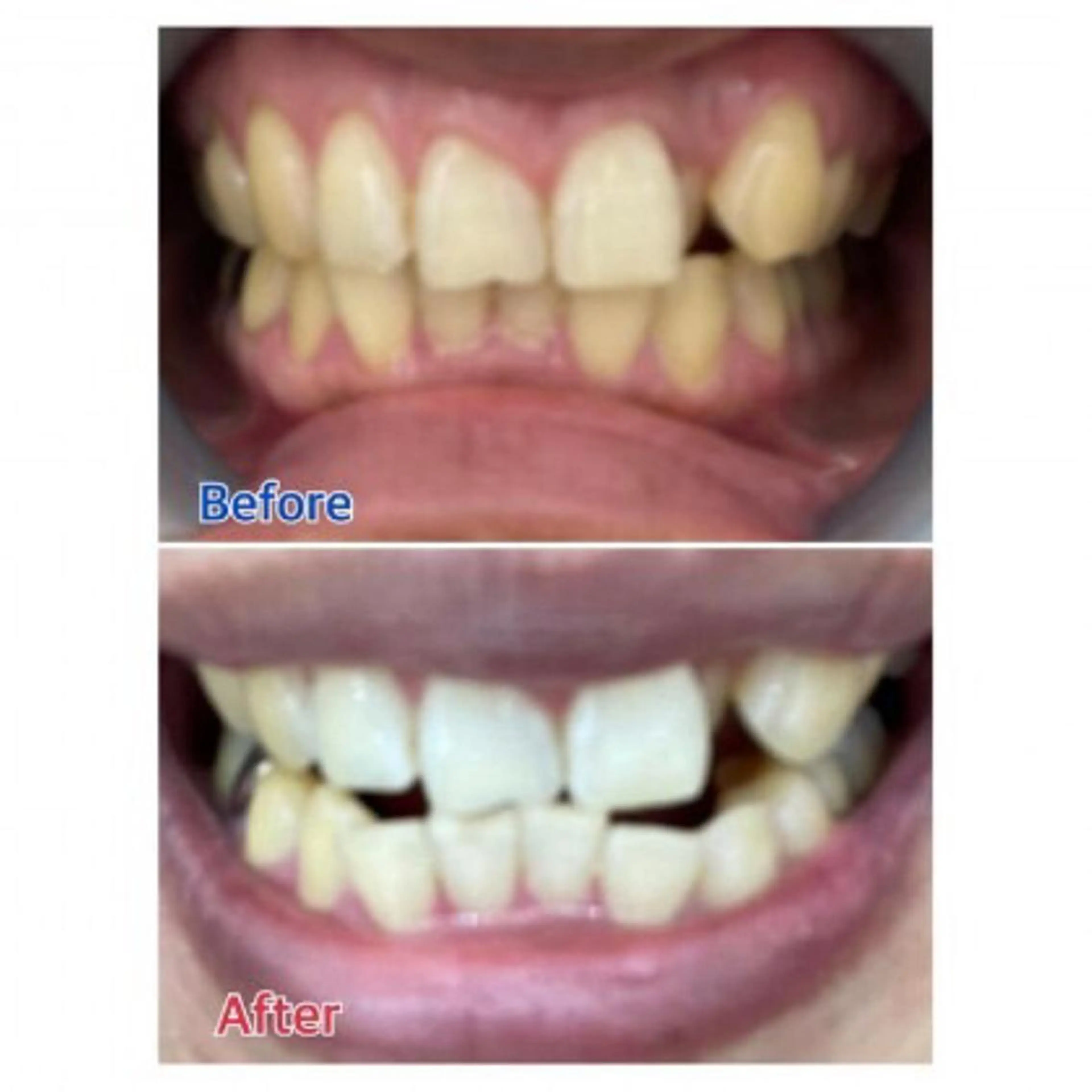 Ｍ渋谷 ホワイトニングのエステ・リラクイメージ