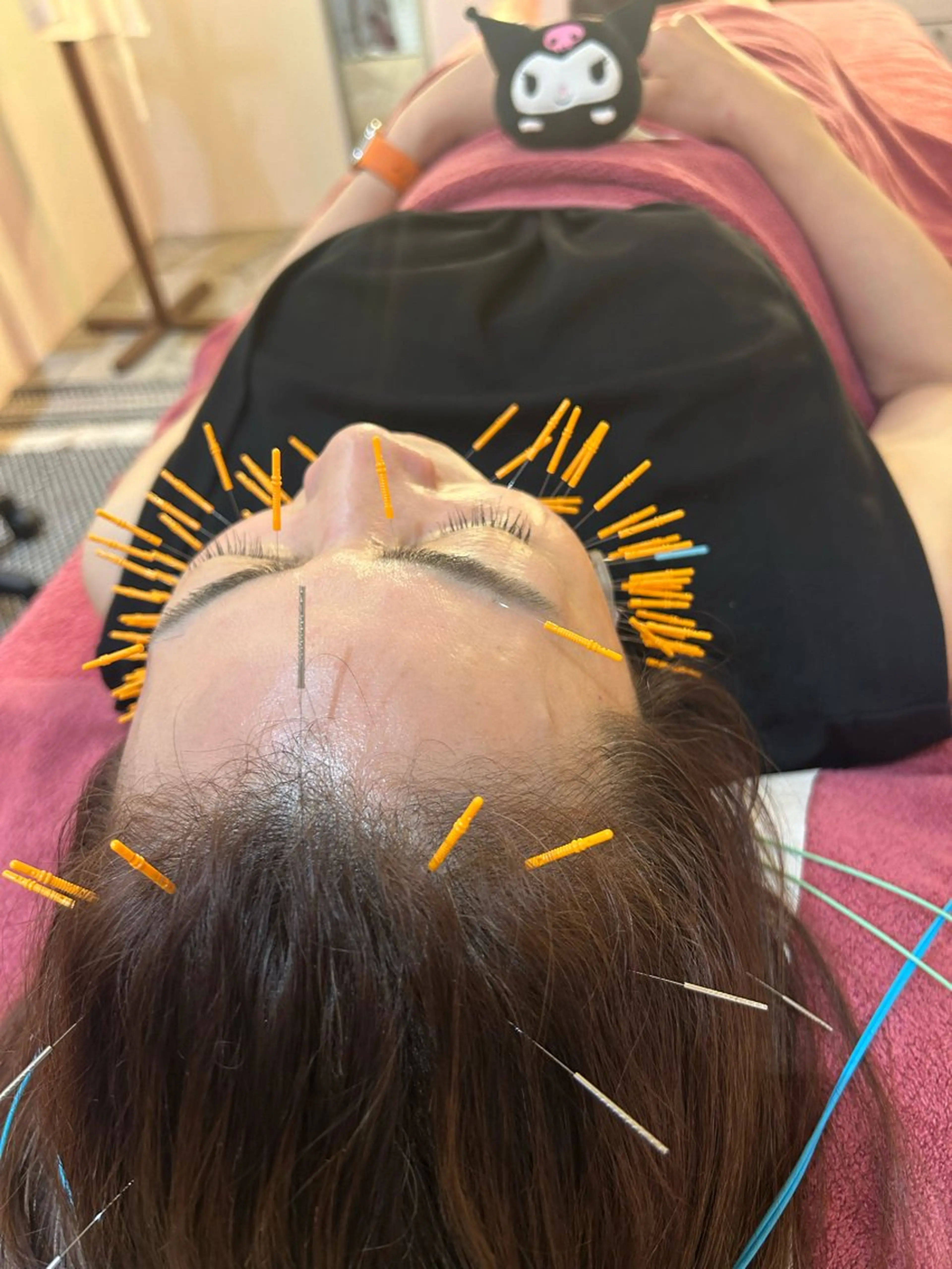 エステ リラク 美容鍼灸女性専用 りんご鍼灸治療院のその他イメージ