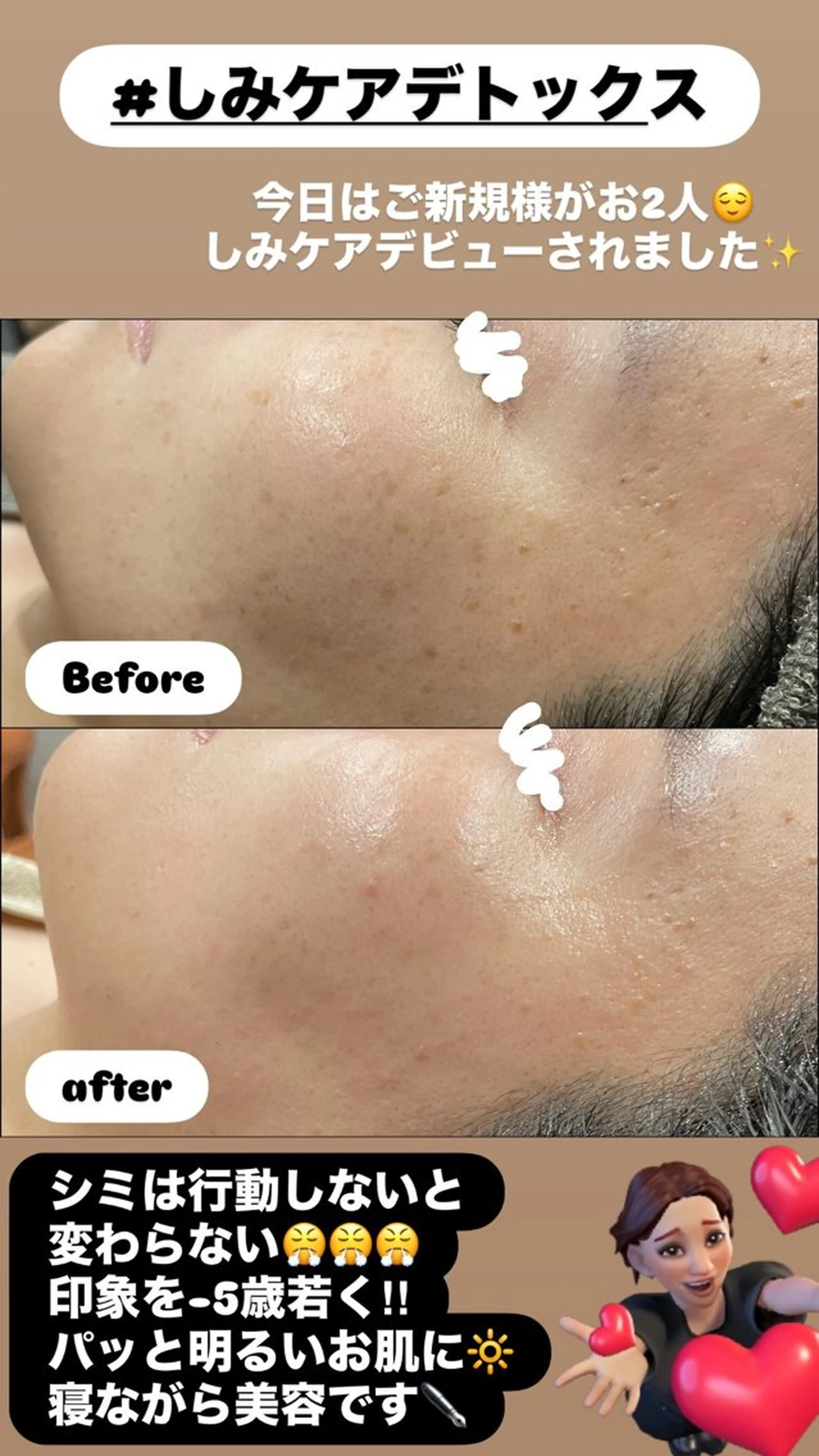 エステ LiZA エステティックサロンのエステ・リラクイメージ