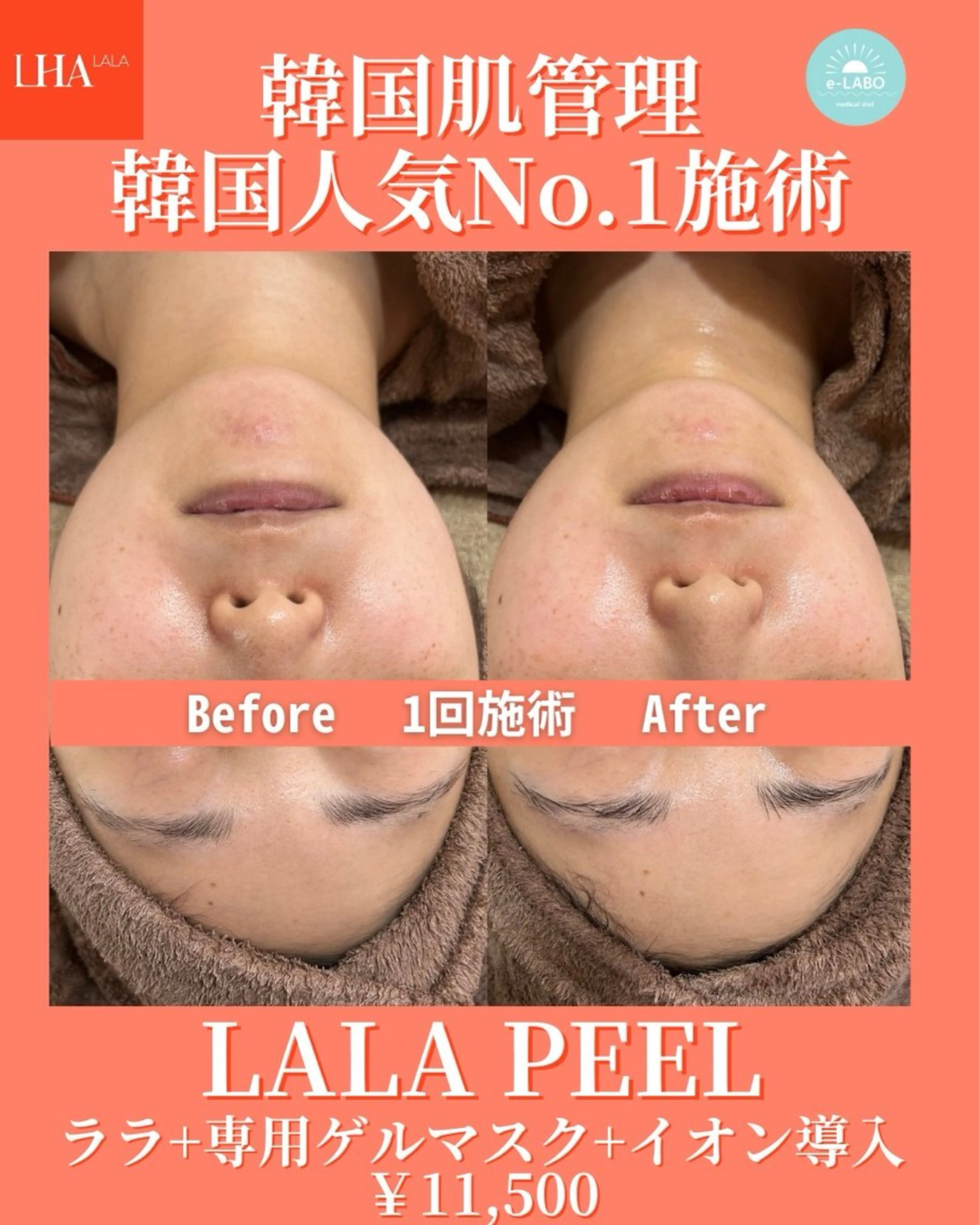 エステ e-LABO 池袋のその他イメージ