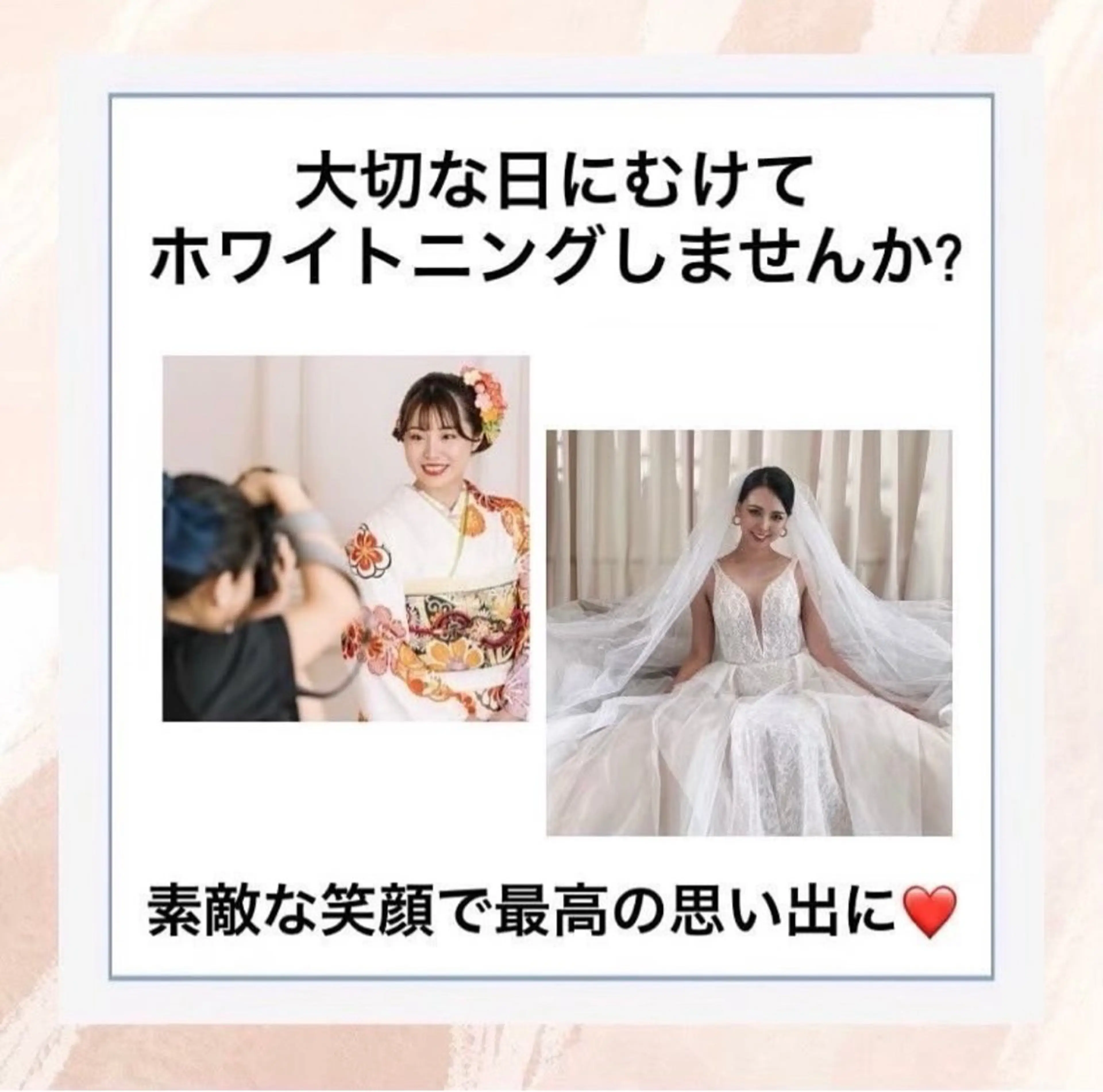 ホワイトニング ショップ伊丹店のその他イメージ