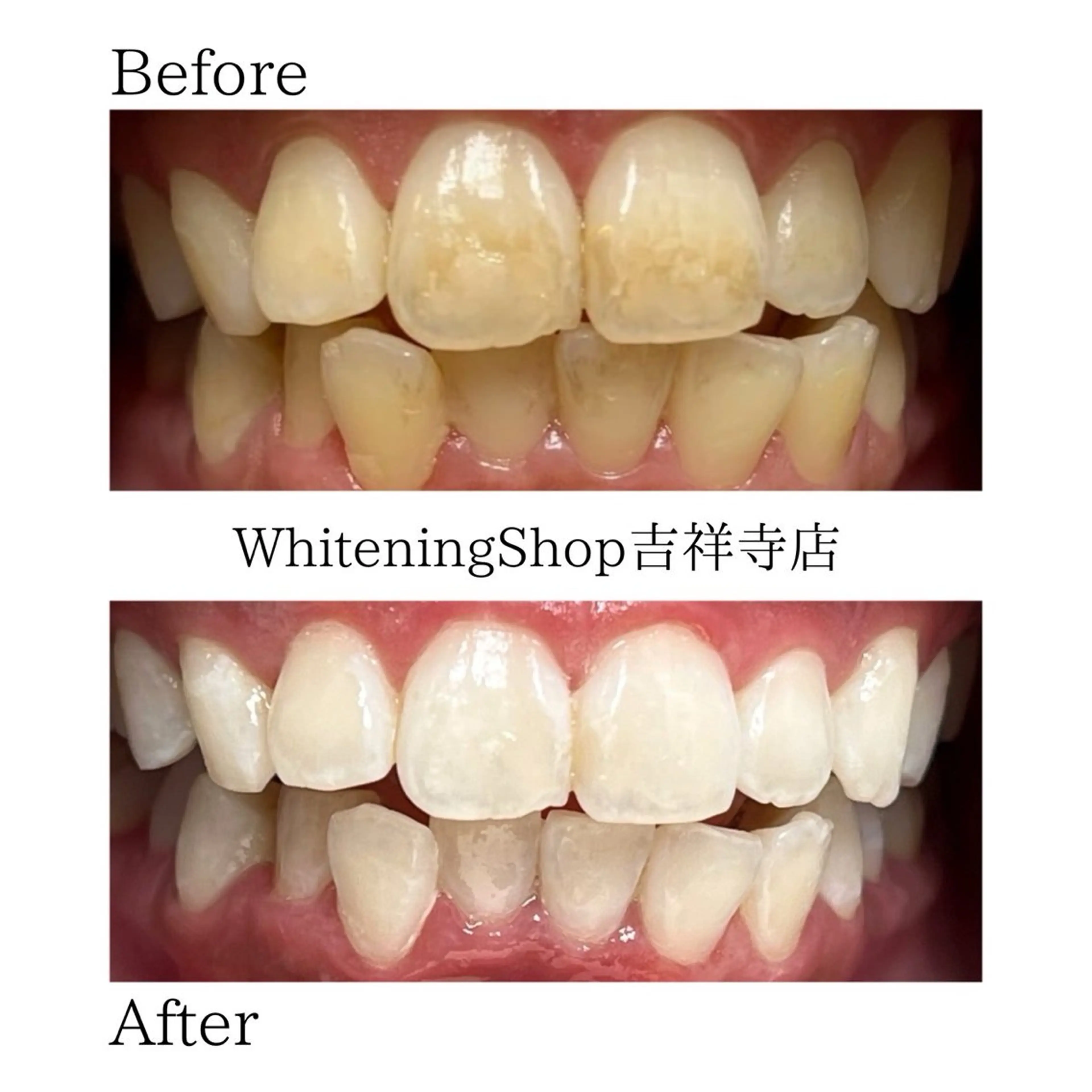 エステ リラク ホワイトニング ショップ吉祥寺店のエステ・リラクイメージ