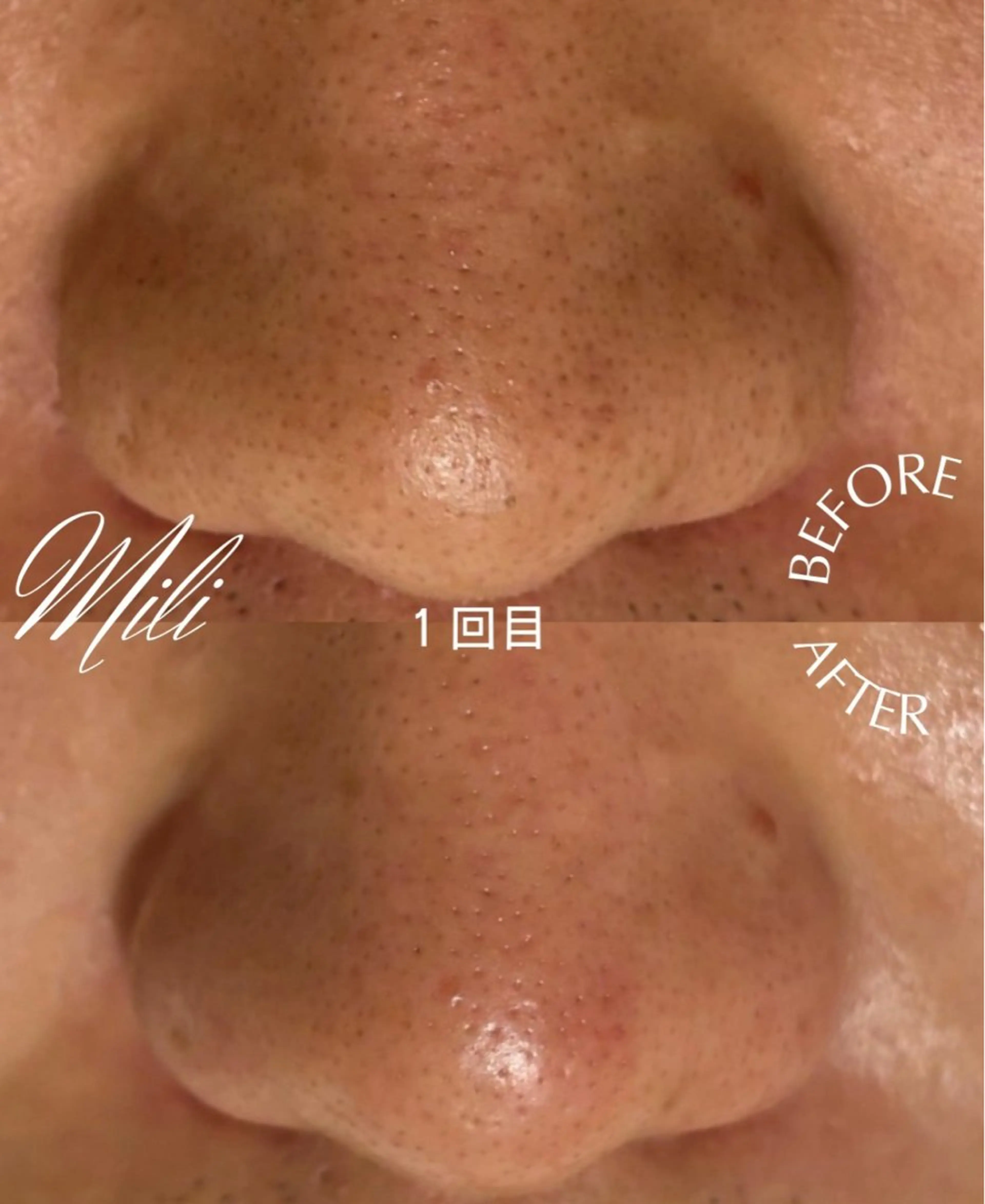 毛穴専門店 mili柏のエステ・リラクイメージ