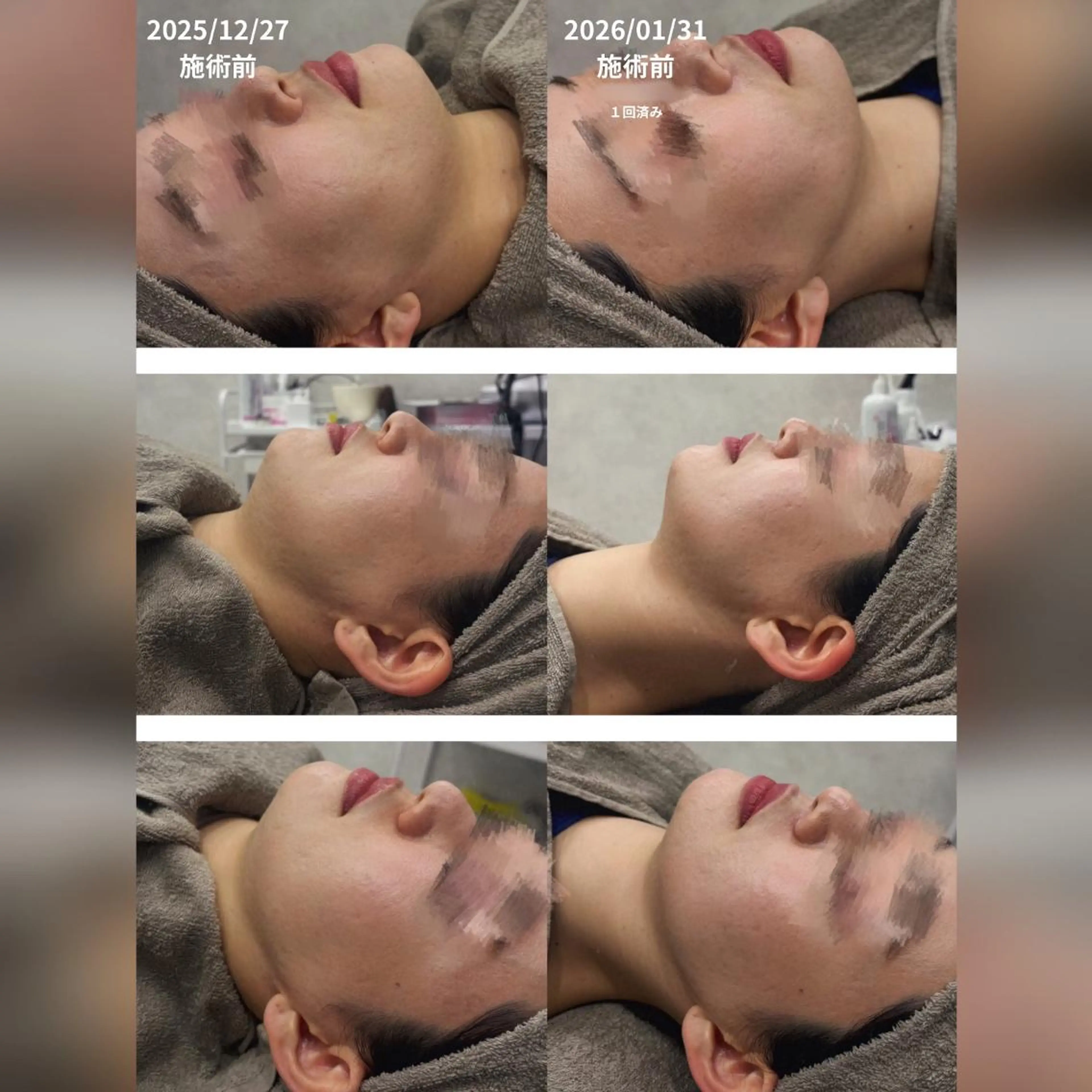 心斎橋🤍堀江.小顔 ハーブ.痩身クレビアのエステ・リラクイメージ