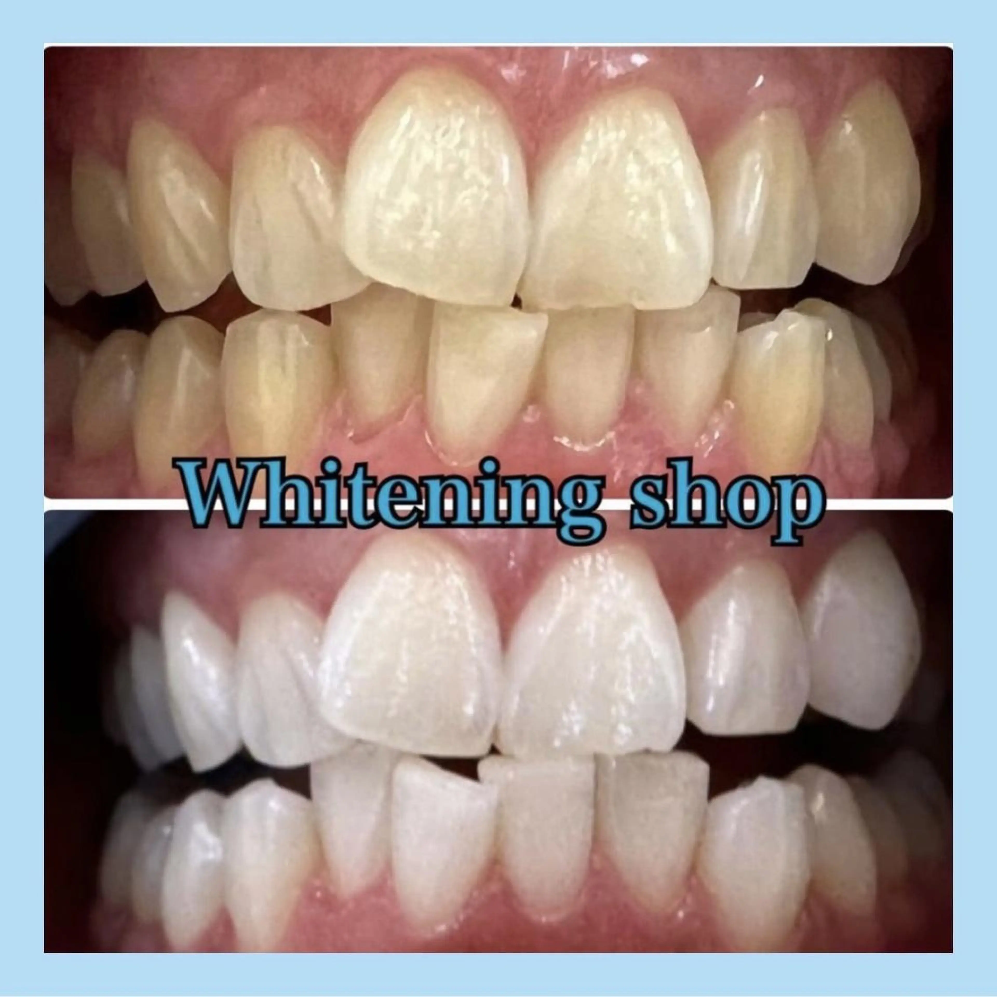 ホワイトニング ショップ千葉店のその他イメージ