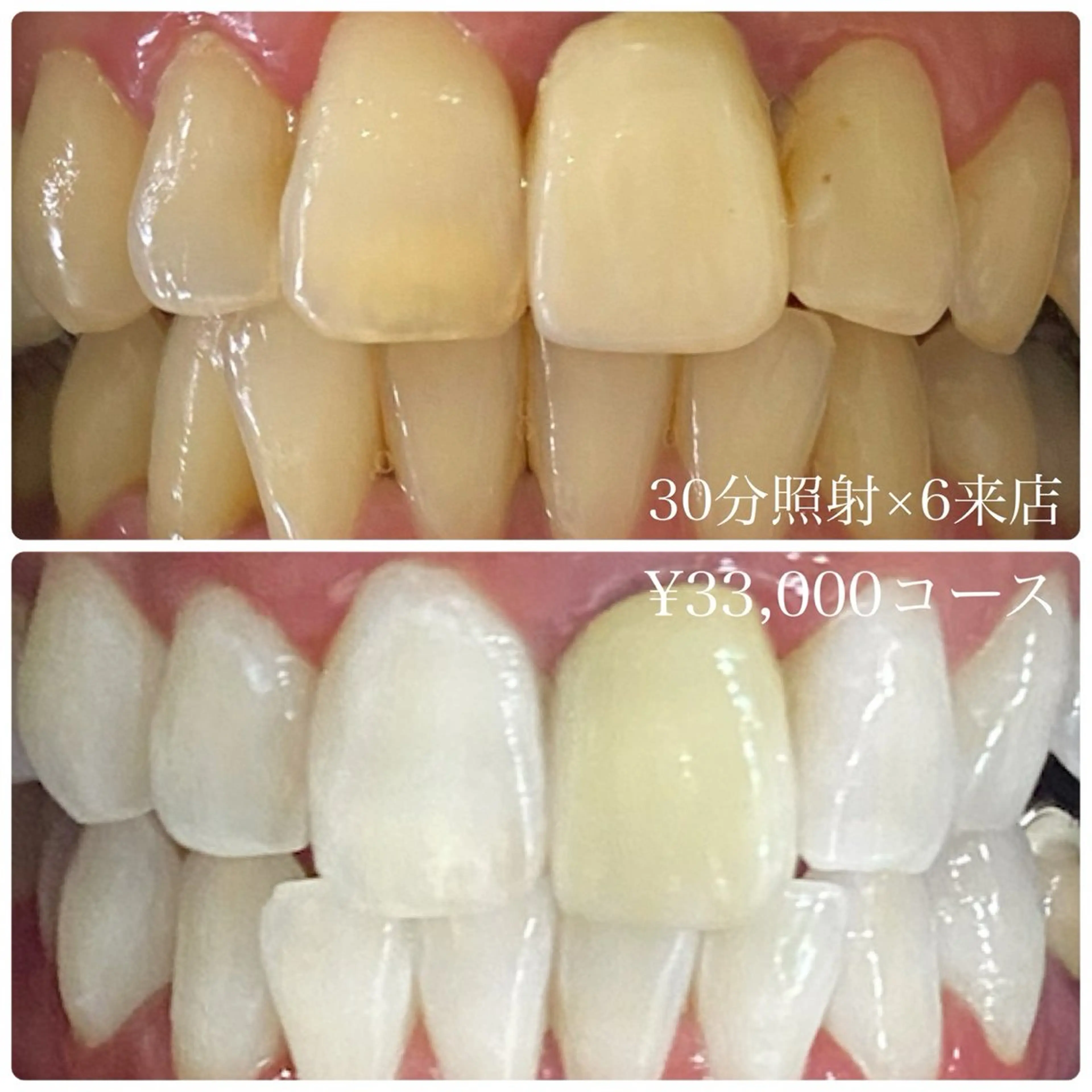 その他 PLATINUM Beauty 横浜店所属・ホワイトニングルーム 横浜店のその他イメージ