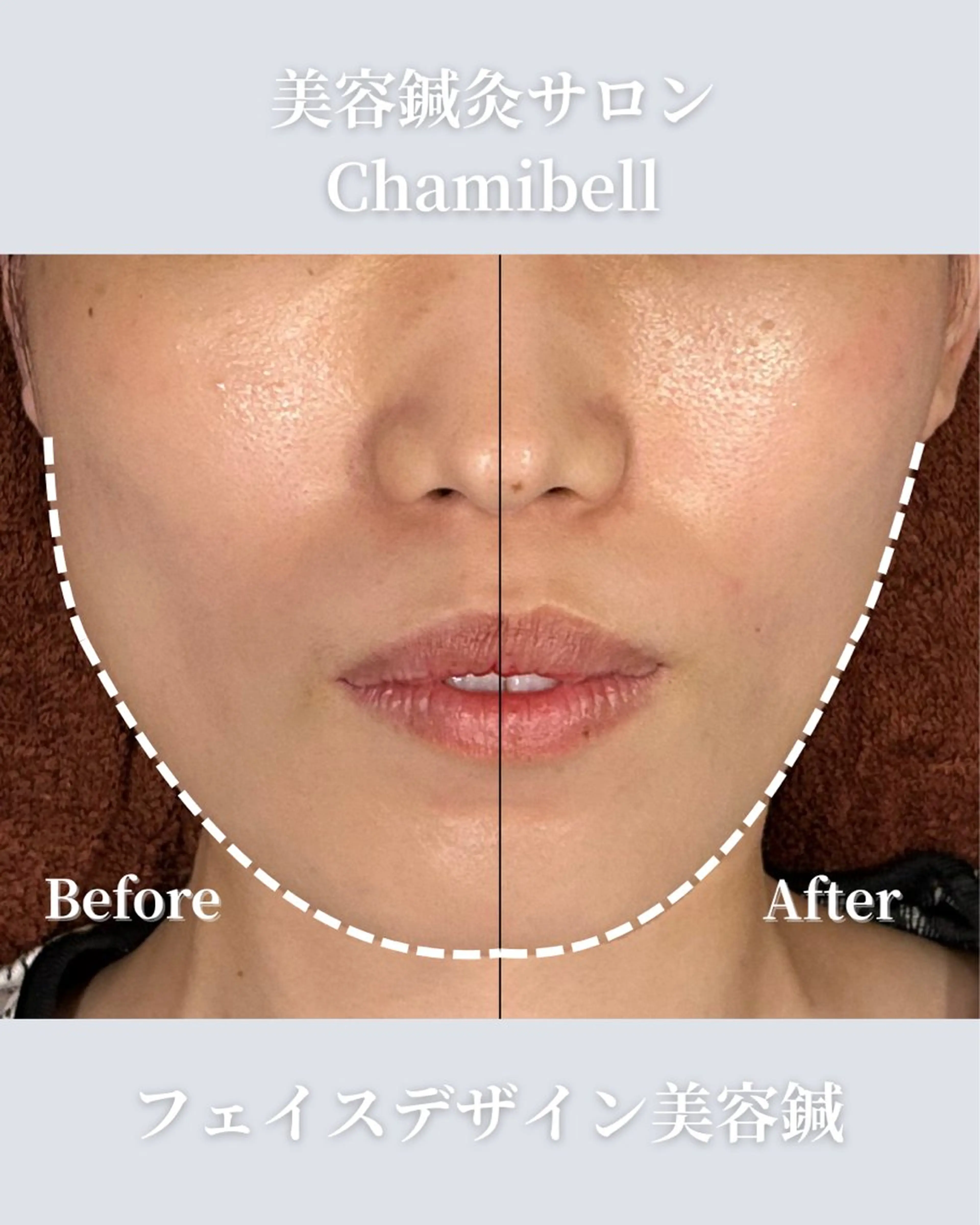 エステ リラク 美容鍼灸サロン Chamibelleのエステ・リラクイメージ