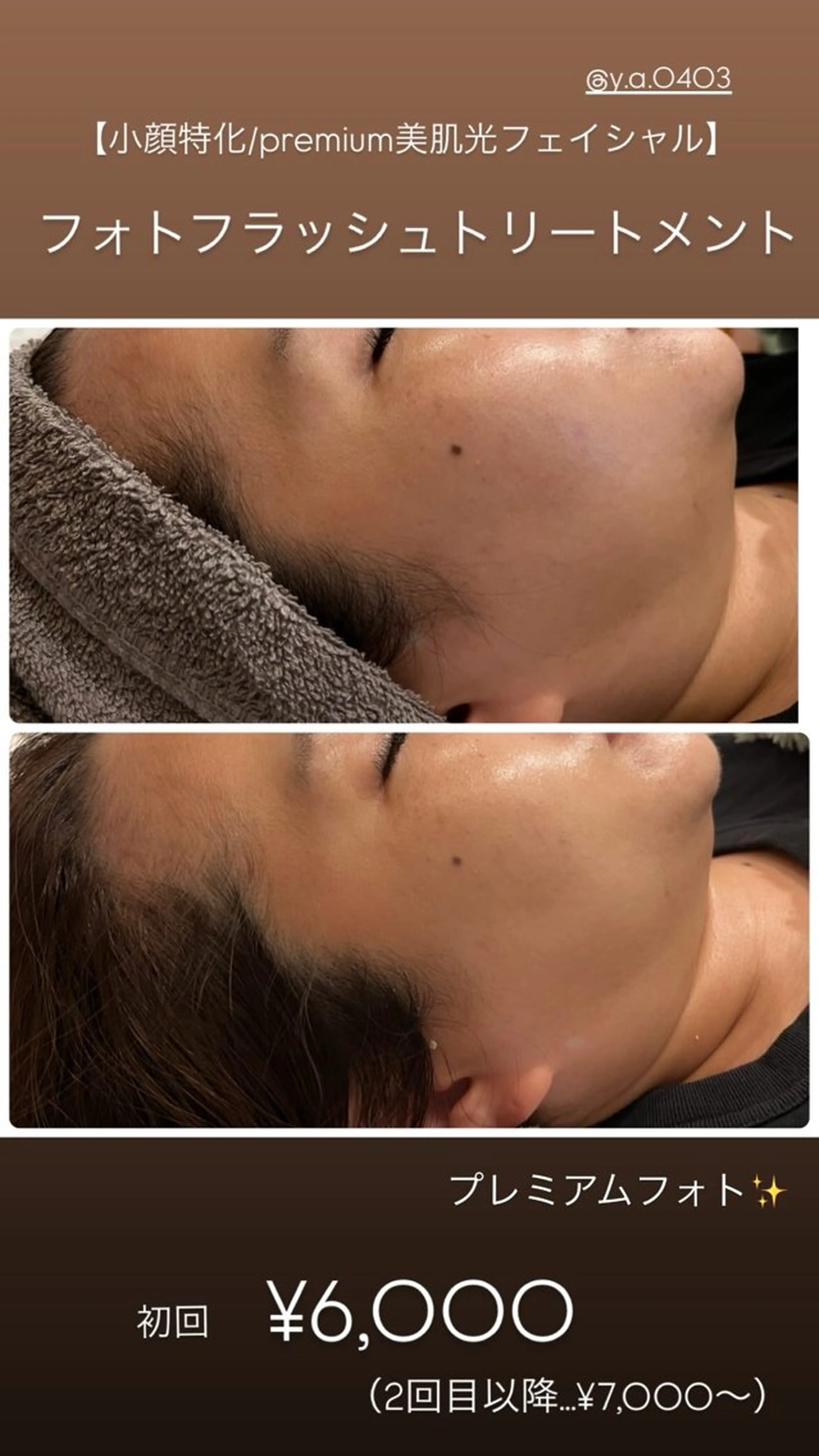 エステ yellow.所属・yellow💛【 脱毛&フェイシャル】のエステ・リラクイメージ