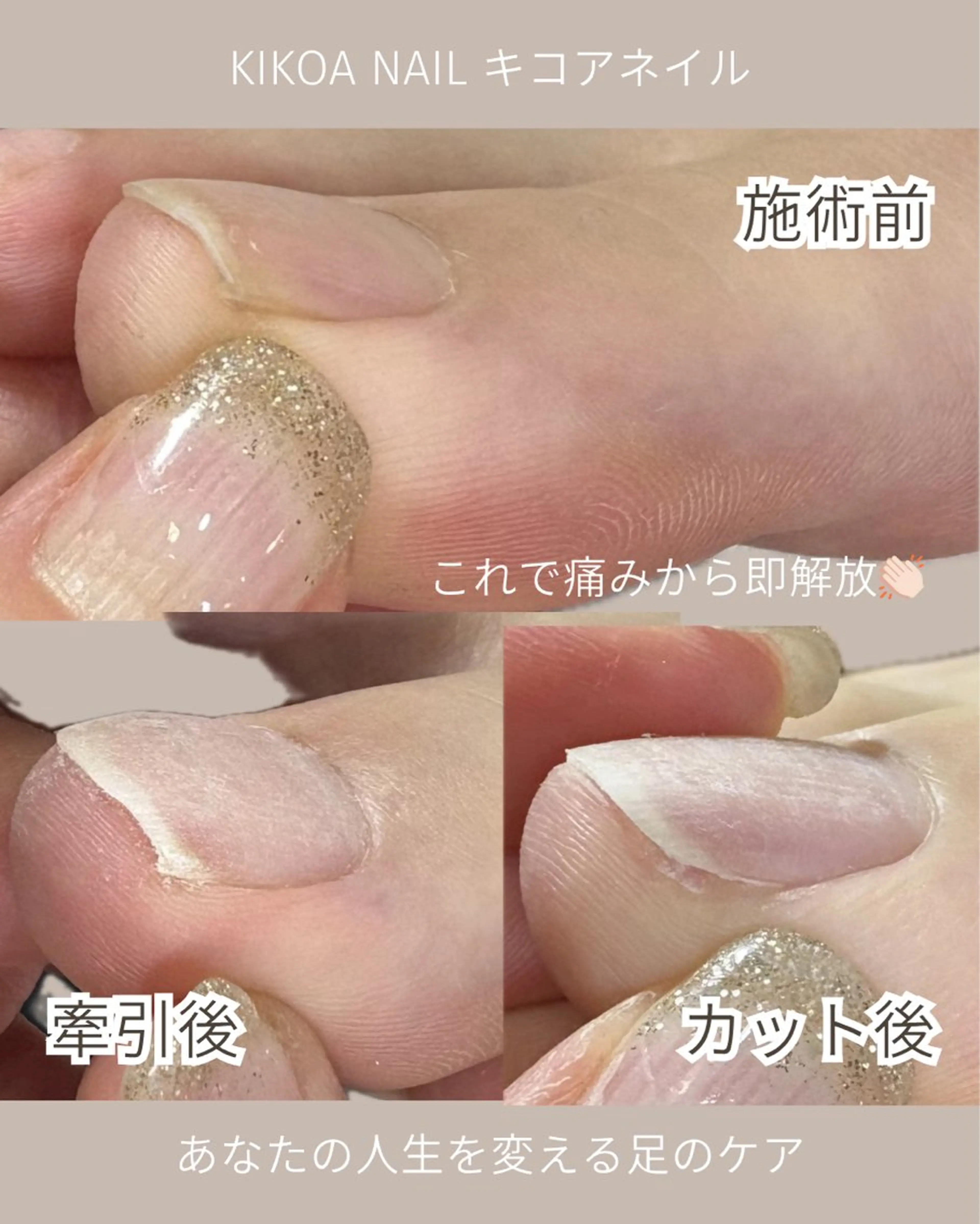 ネイル KIKOA NAIL キコアネイルのネイルデザイン