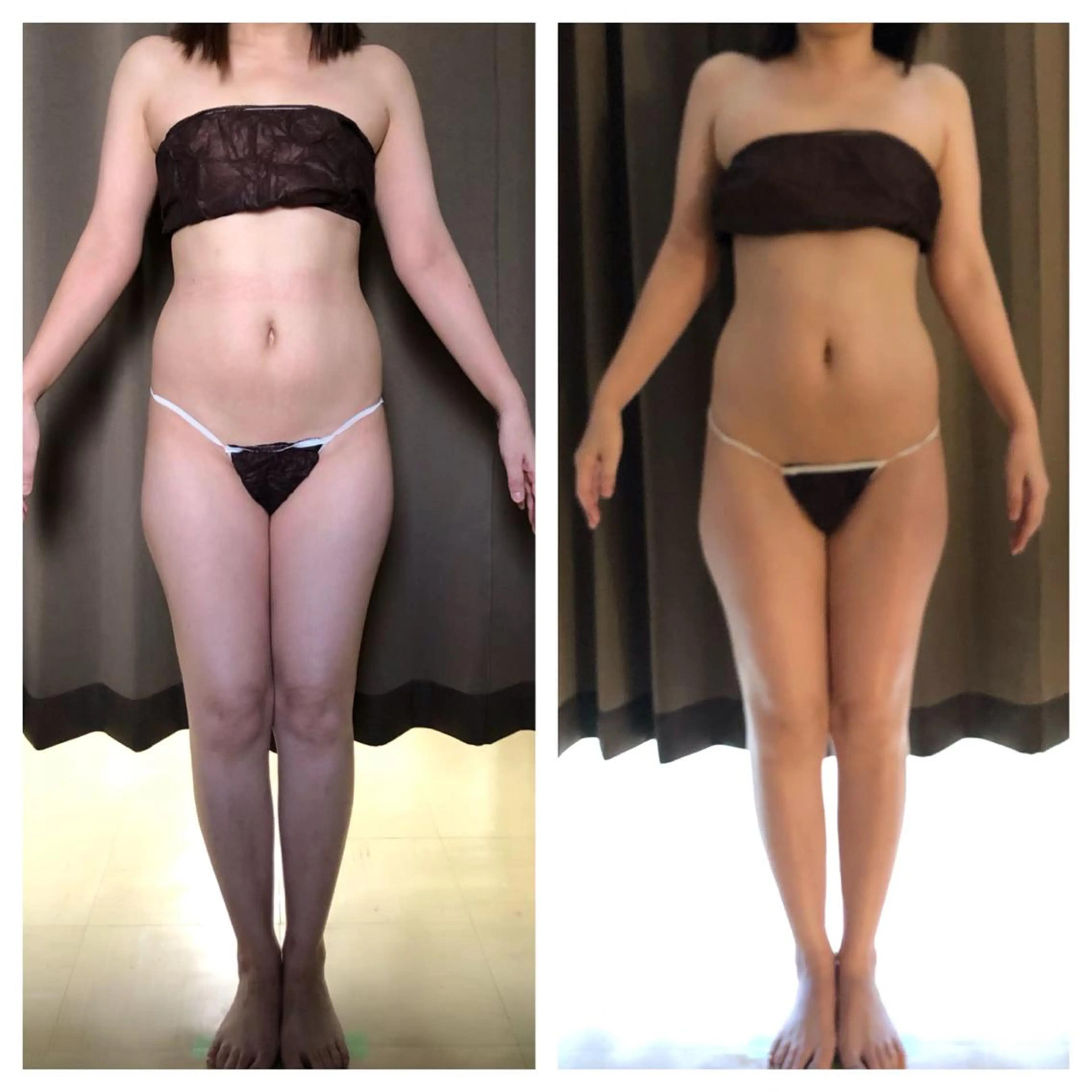 小顔.足痩せ整体 痩身天六Sunaoのその他イメージ