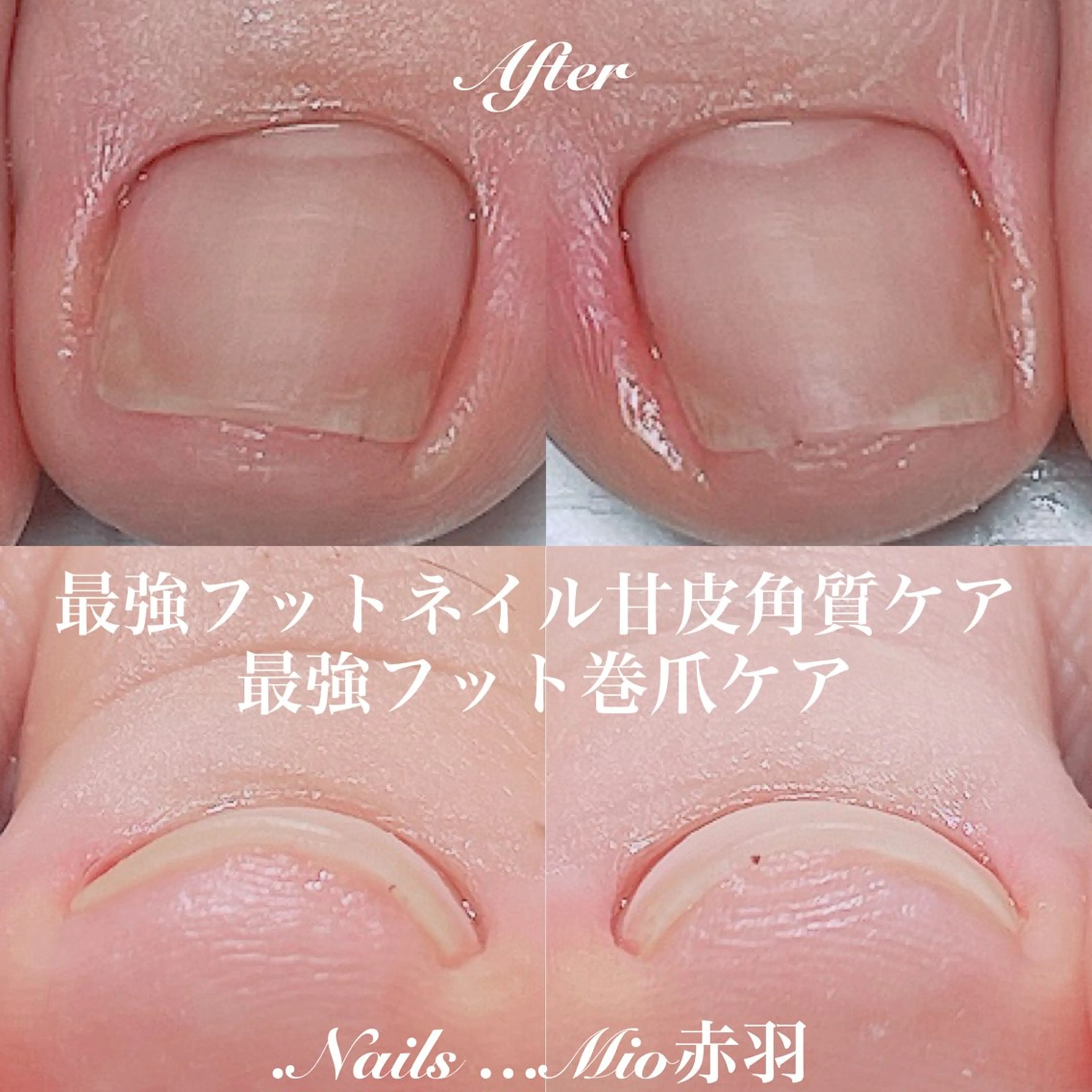 ネイル フットネイル .Nails Mio 赤羽西ネイルサロンのネイルデザイン