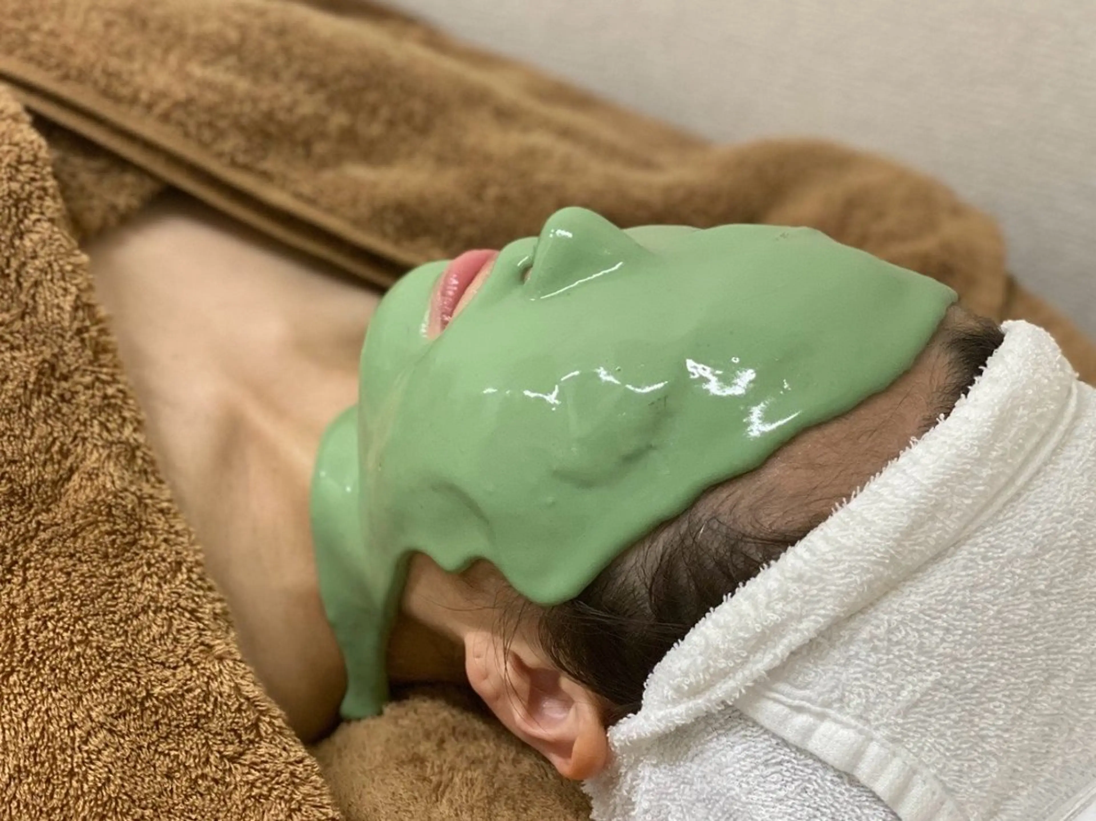 繰り返すニキビ 肌荒れ鎮静コース💚アドバンスコース【イルネージュ使用】 50分+炎症鎮静パック 20分の写真