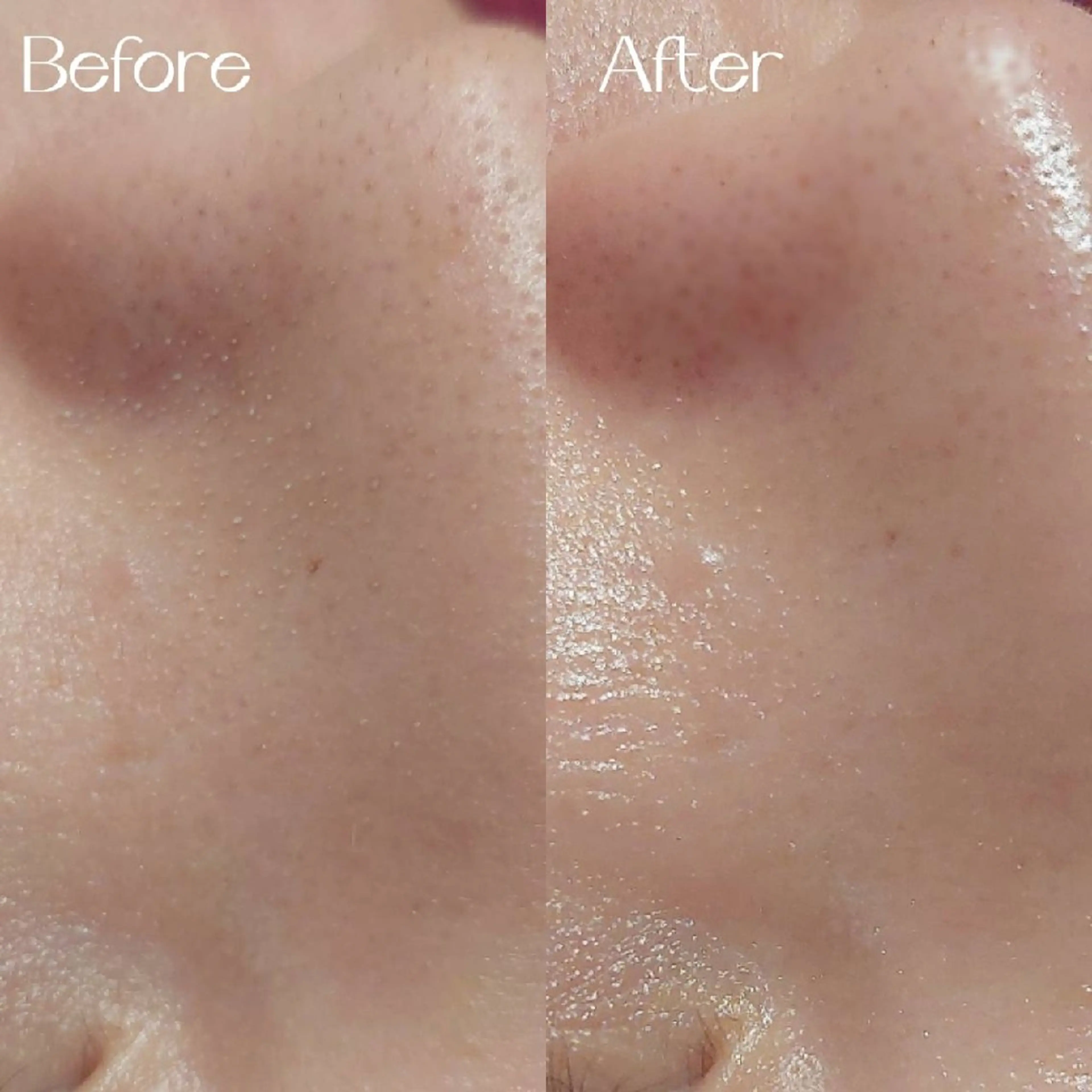 エステ MyFairLady miuのエステ・リラクイメージ