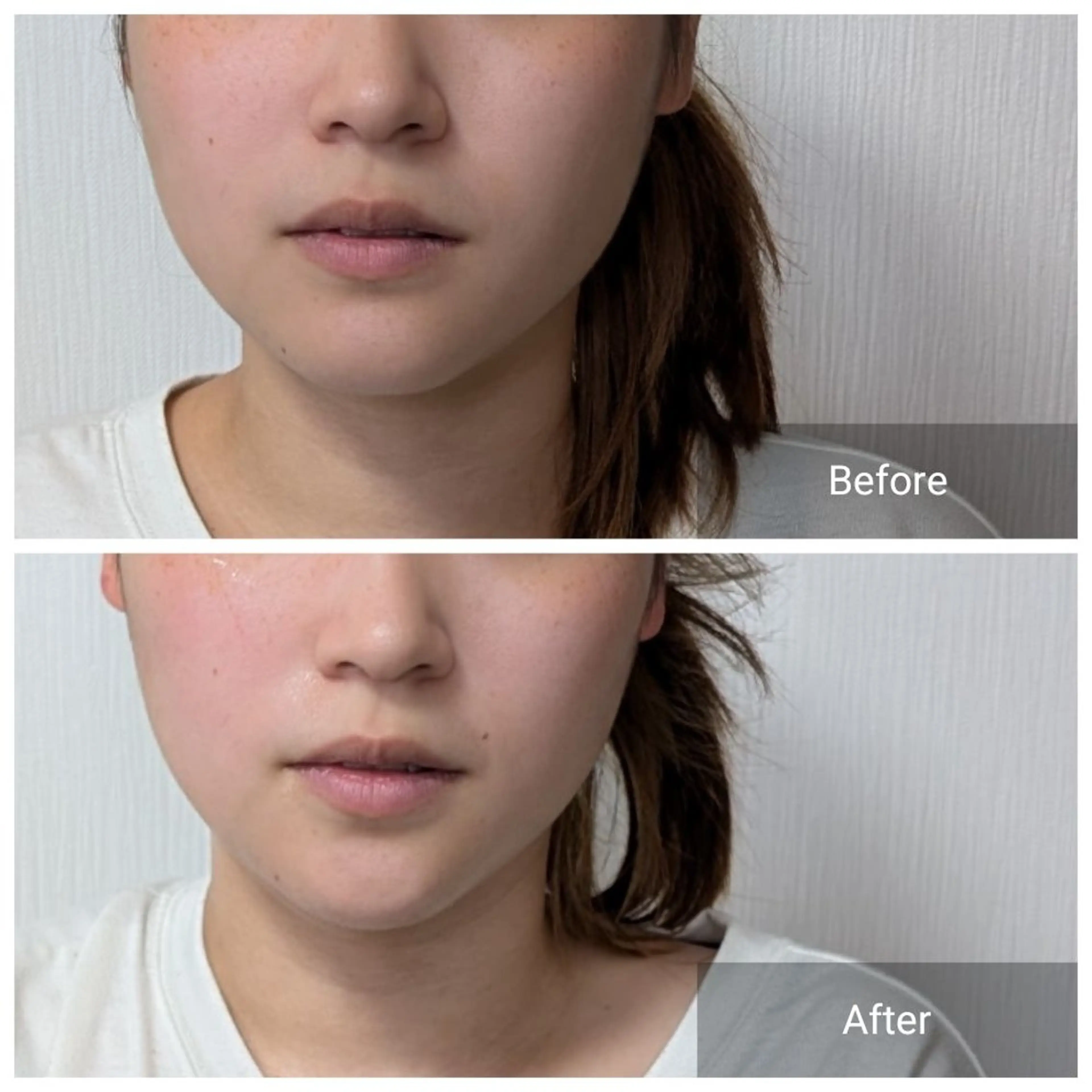 エステ nail RiRi アトレナチュラのエステ・リラクイメージ