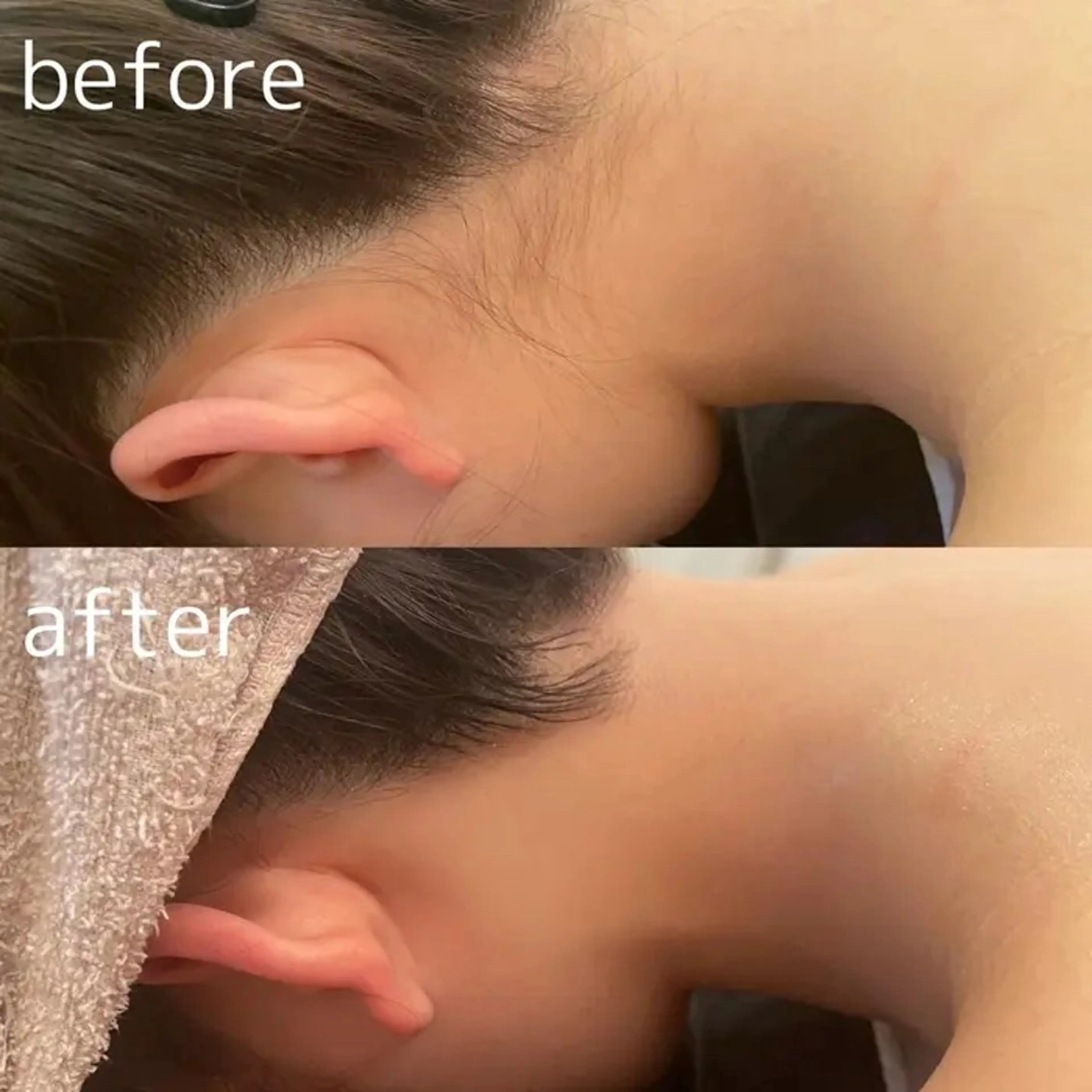 脱毛 Noguchi staffのエステ・リラクイメージ