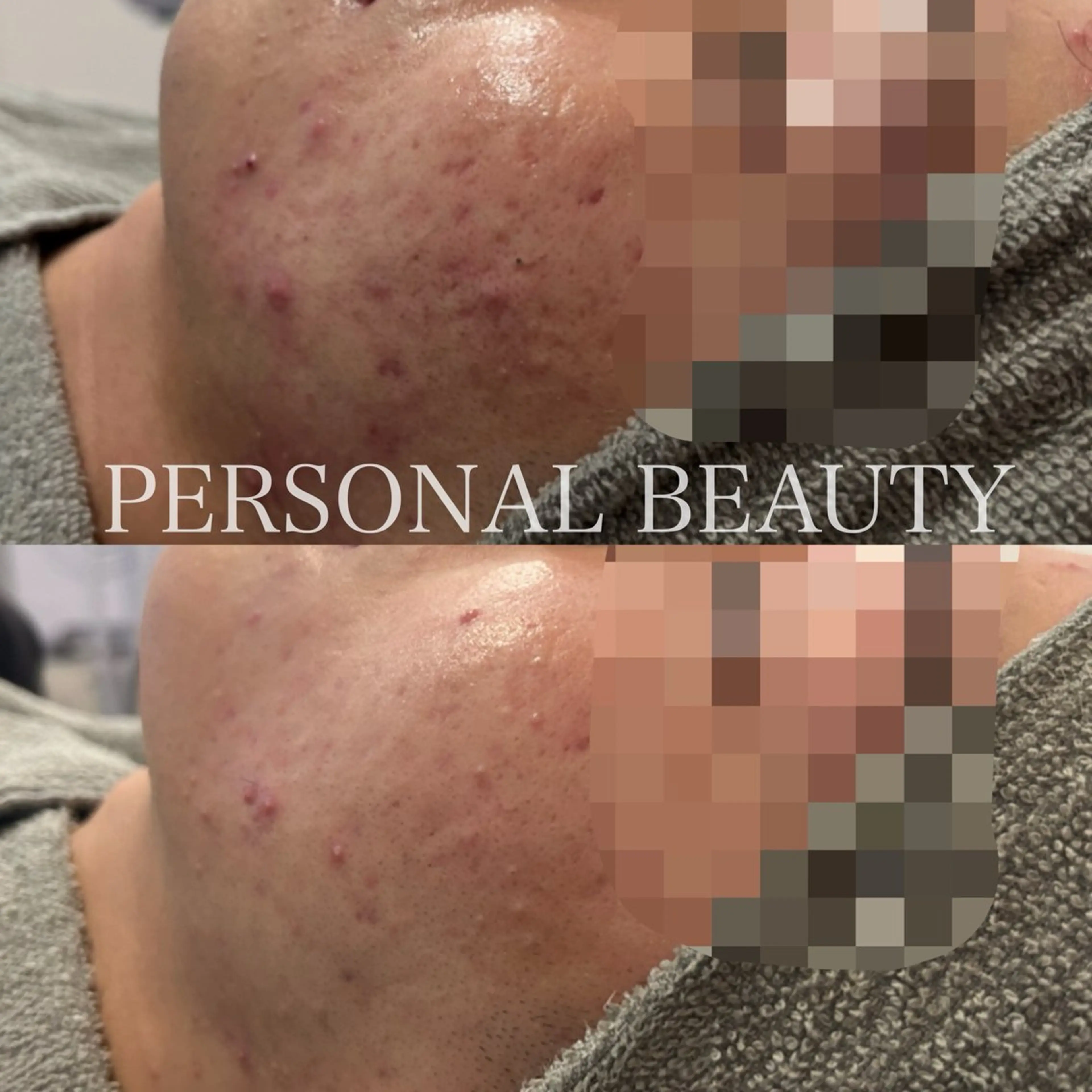 PERSONAL BEAUTY🪻のエステ・リラクイメージ