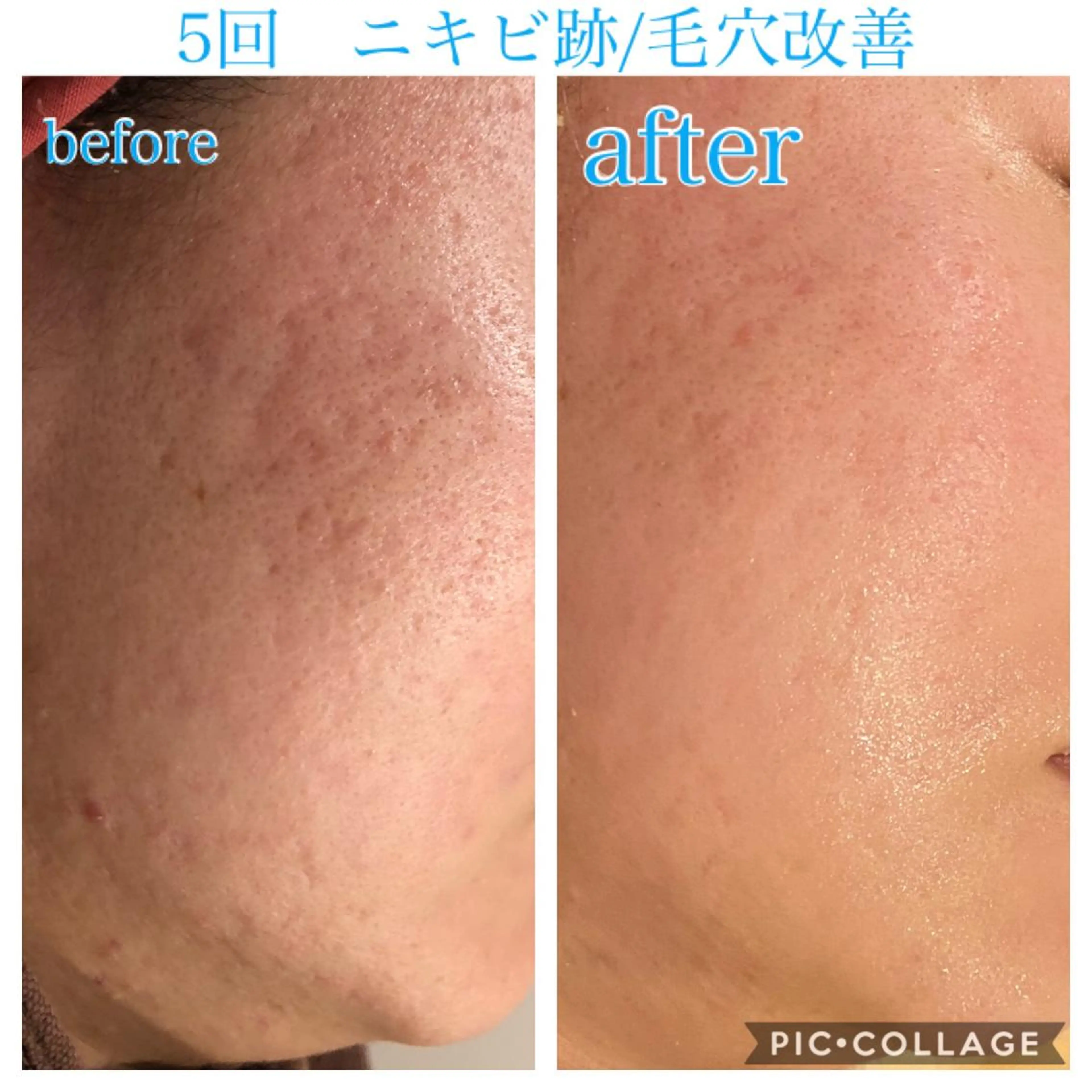 ロング カラー パーマ ヘアアレンジ キッズ ネイル マツエク・マツパ エステ リラク EnsorClair 代表　野口真央のエステ・リラクイメージ