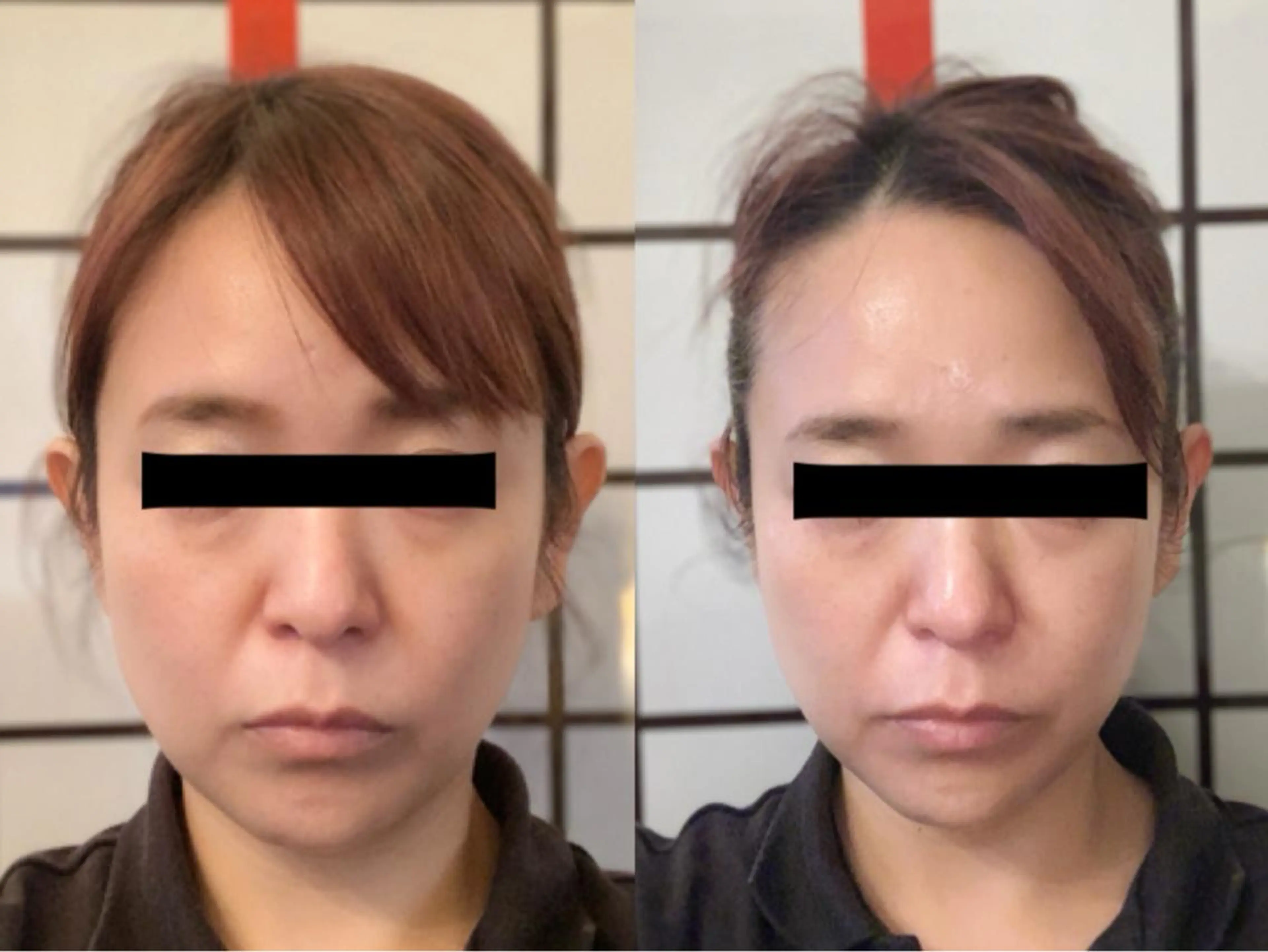 エステ ハイフ・小顔・骨盤 シャングリラのエステ・リラクイメージ