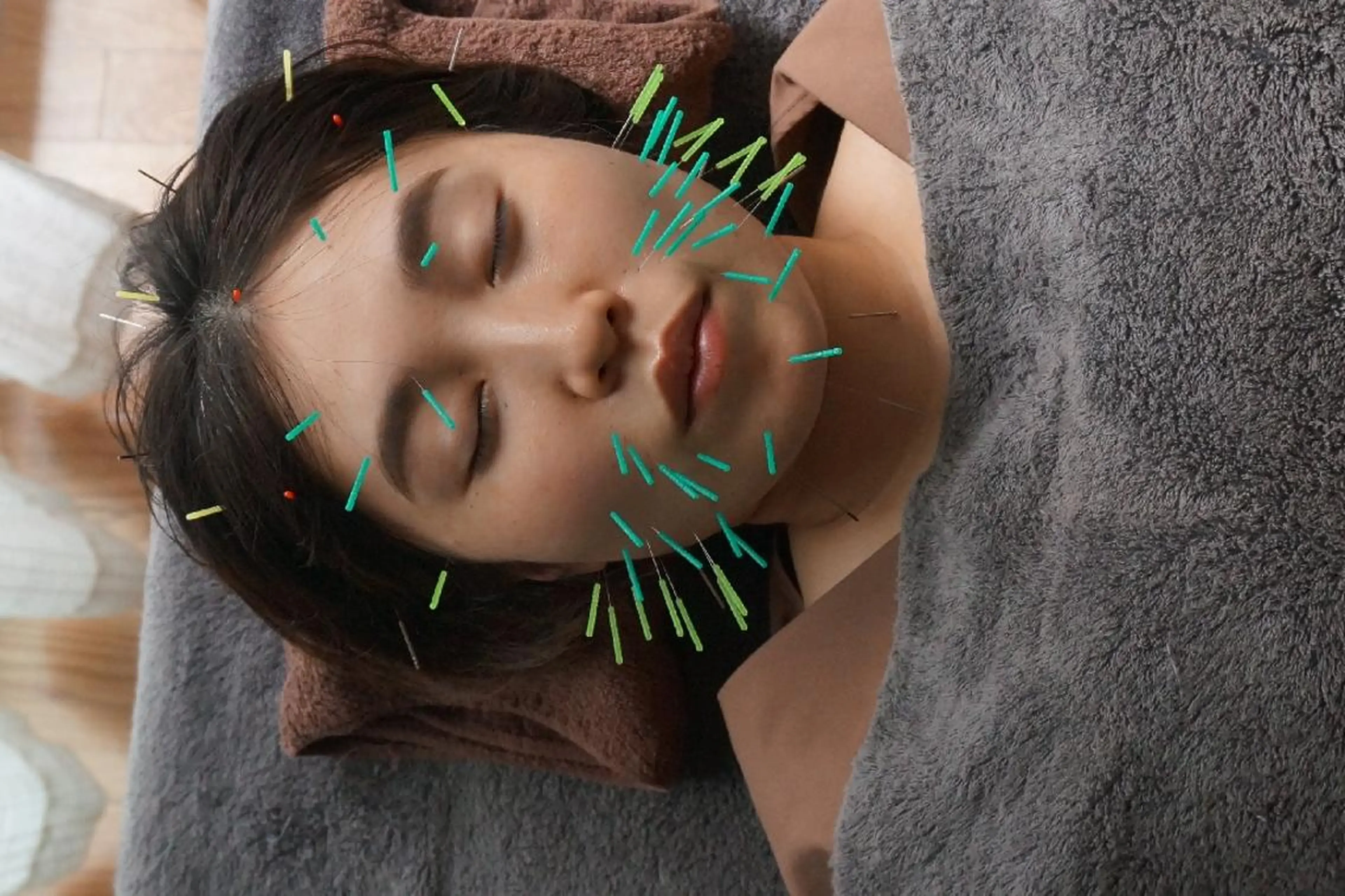 エステ 即効⚡小顔美容鍼🪡 むくみたるみ脂肪解消のエステ・リラクイメージ