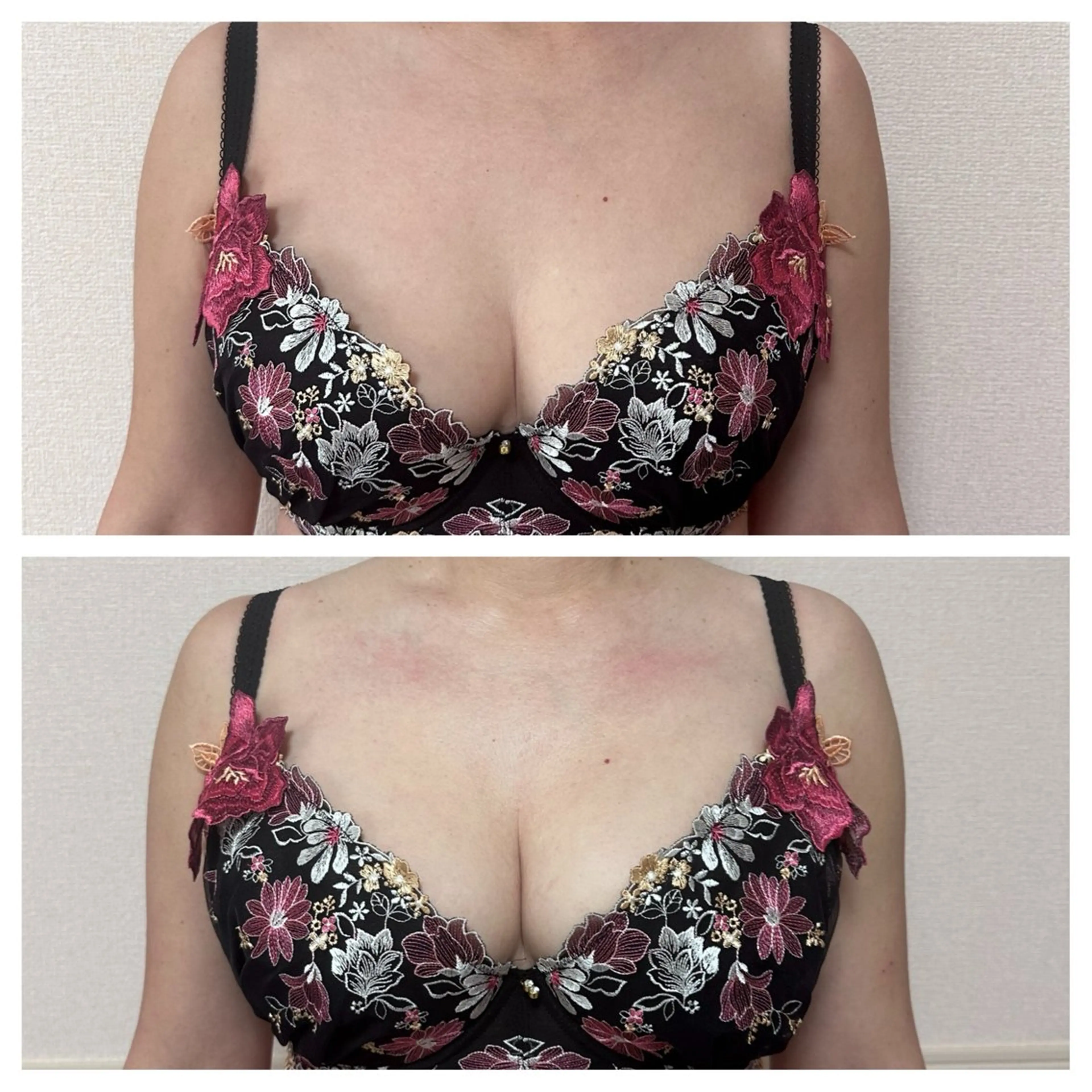 エステ バストアップサロン Mielのエステ・リラクイメージ