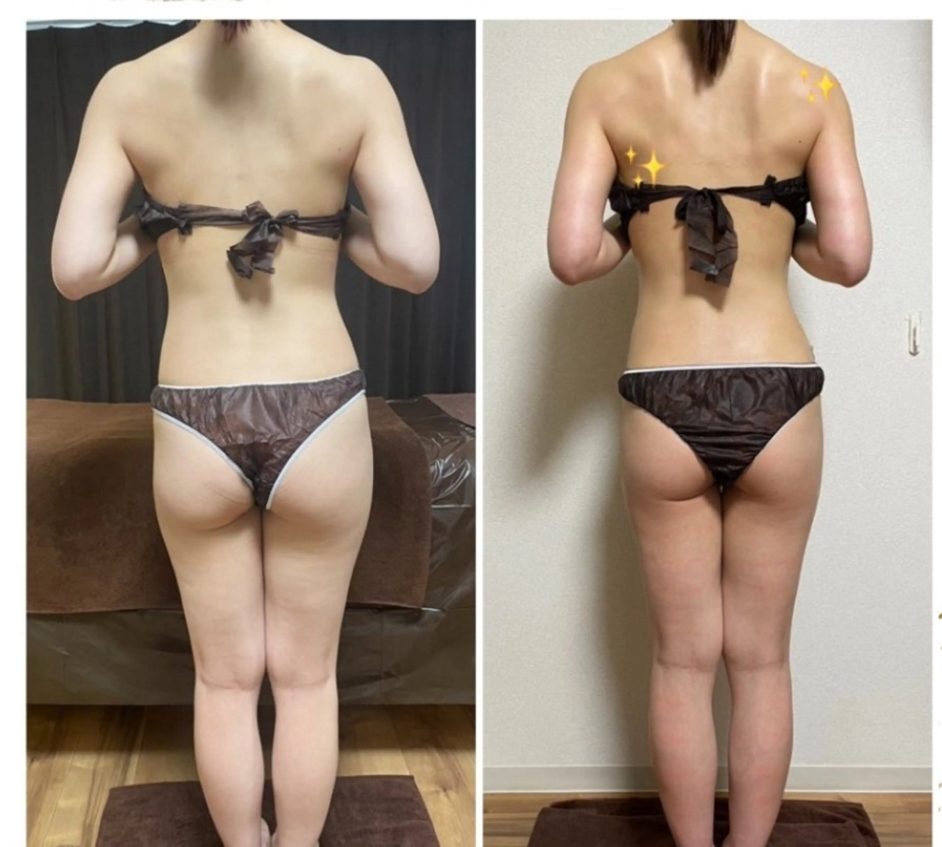 仮予約パワーレメディ上半身痩せ🌺肩甲骨はがし二の腕くびれ♥首や肩こり撃退の写真