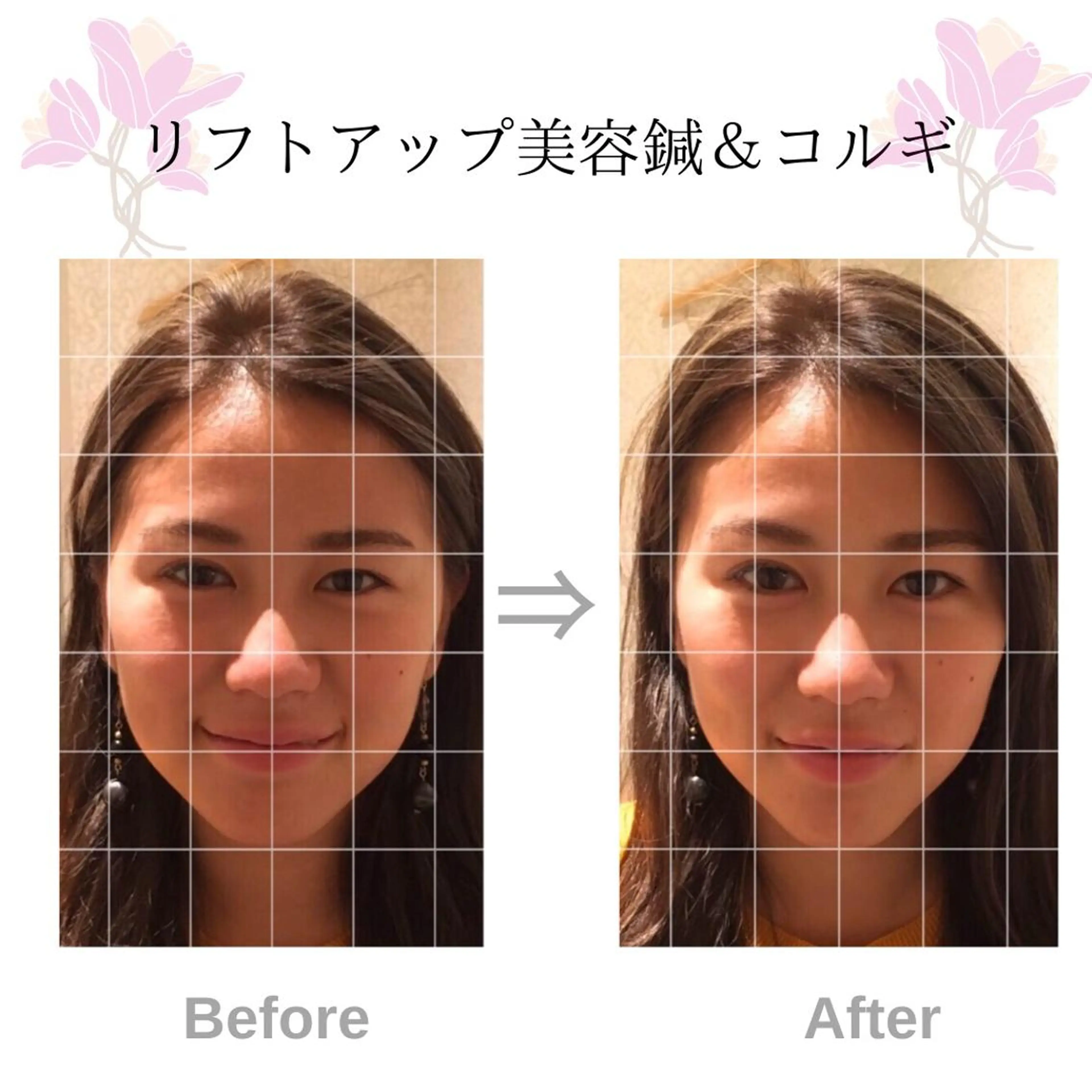 伊藤 かなえのエステ・リラクイメージ