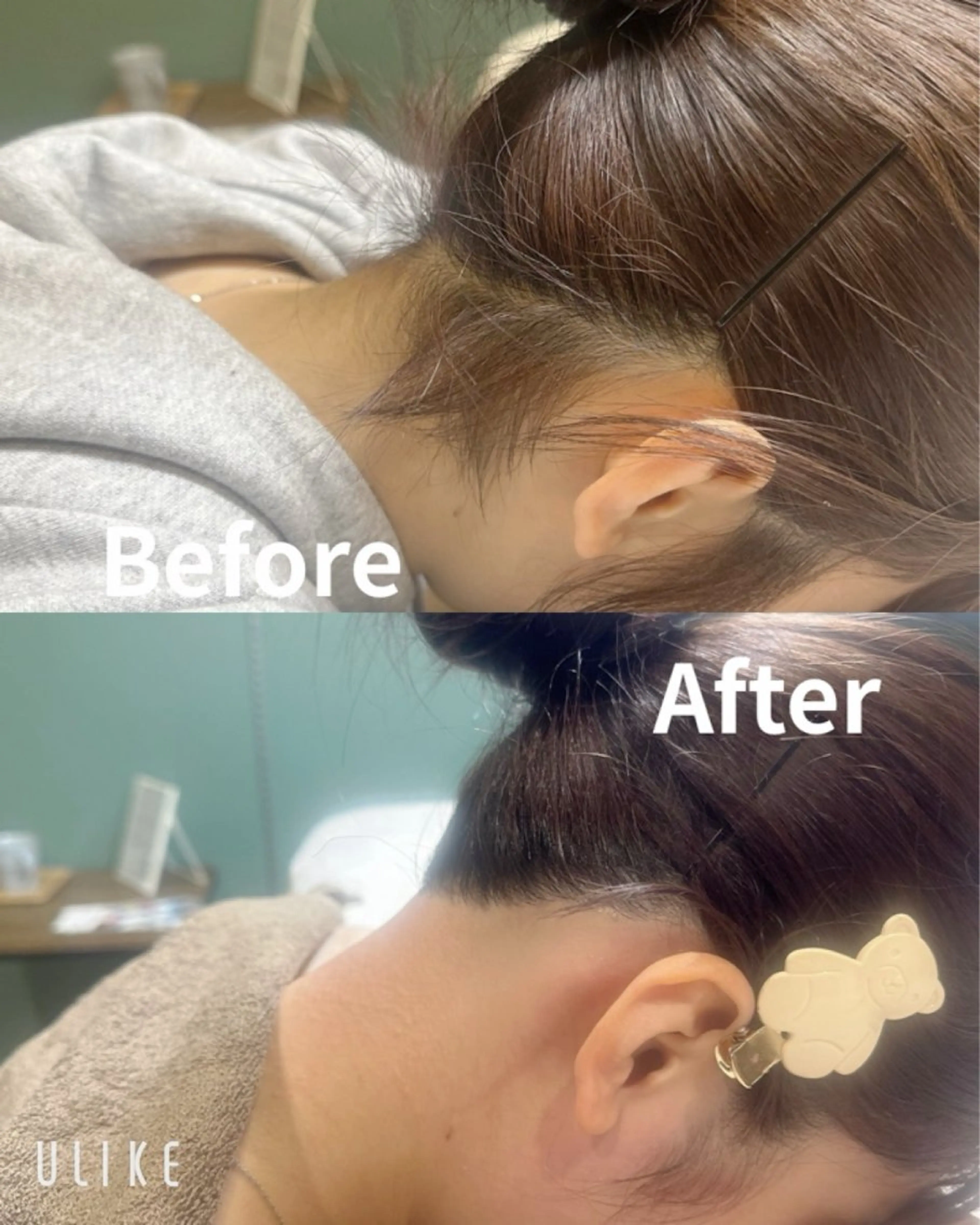 脱毛 KOHOLA -ワックス脱毛専門-のエステ・リラクイメージ