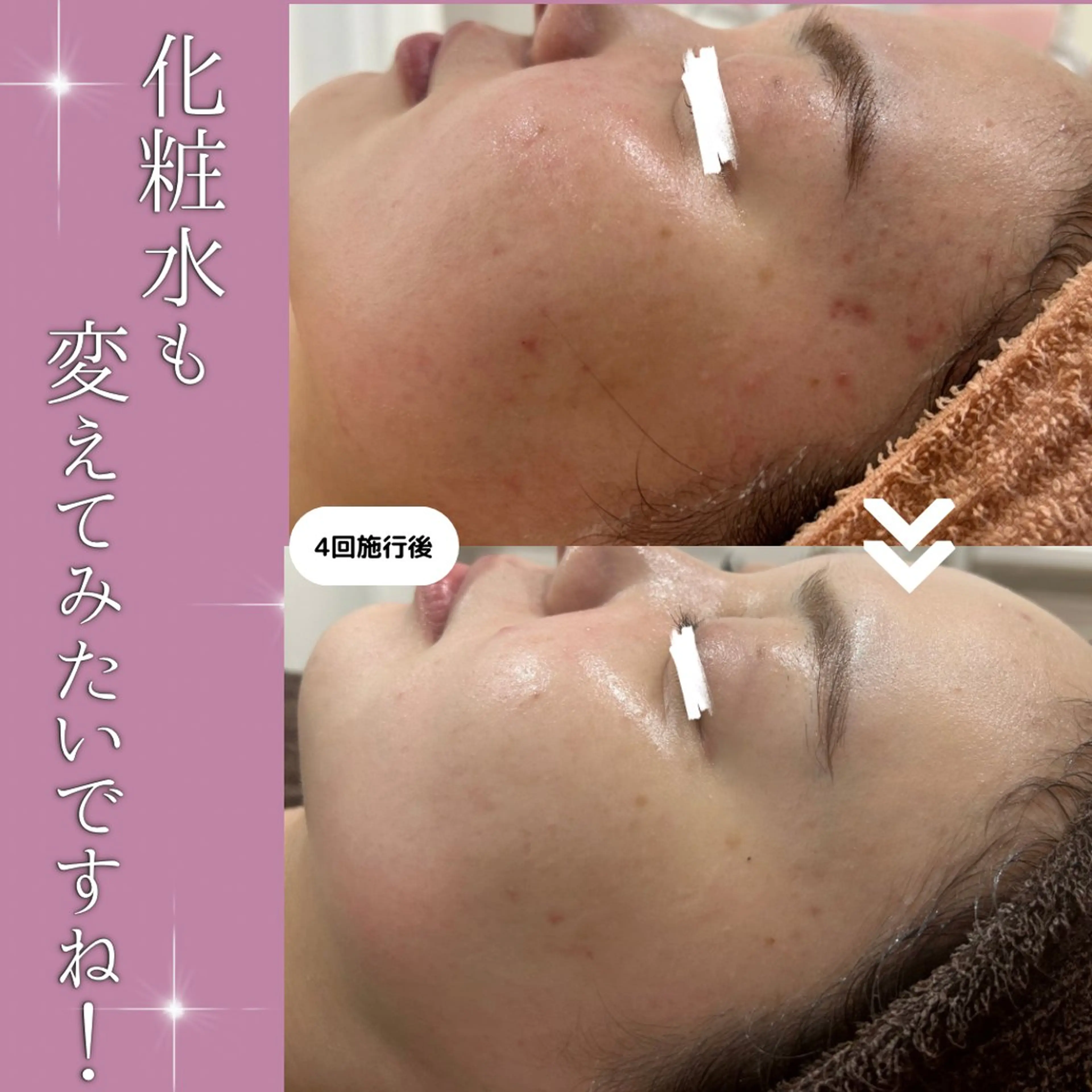 【現役看護師】高来 笑子のエステ・リラクイメージ