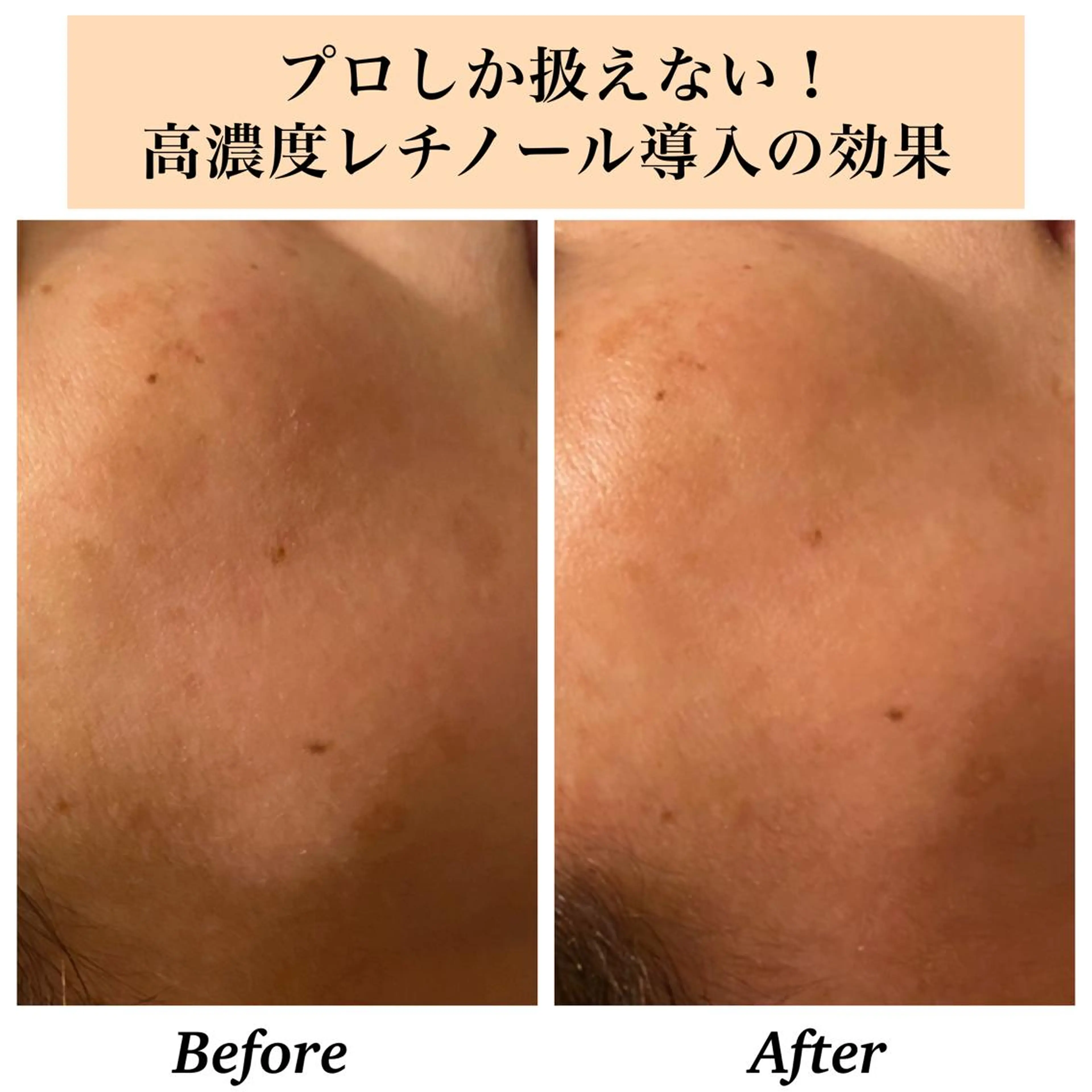 エステ リラク Bellesthe （ベルエステ）のエステ・リラクイメージ