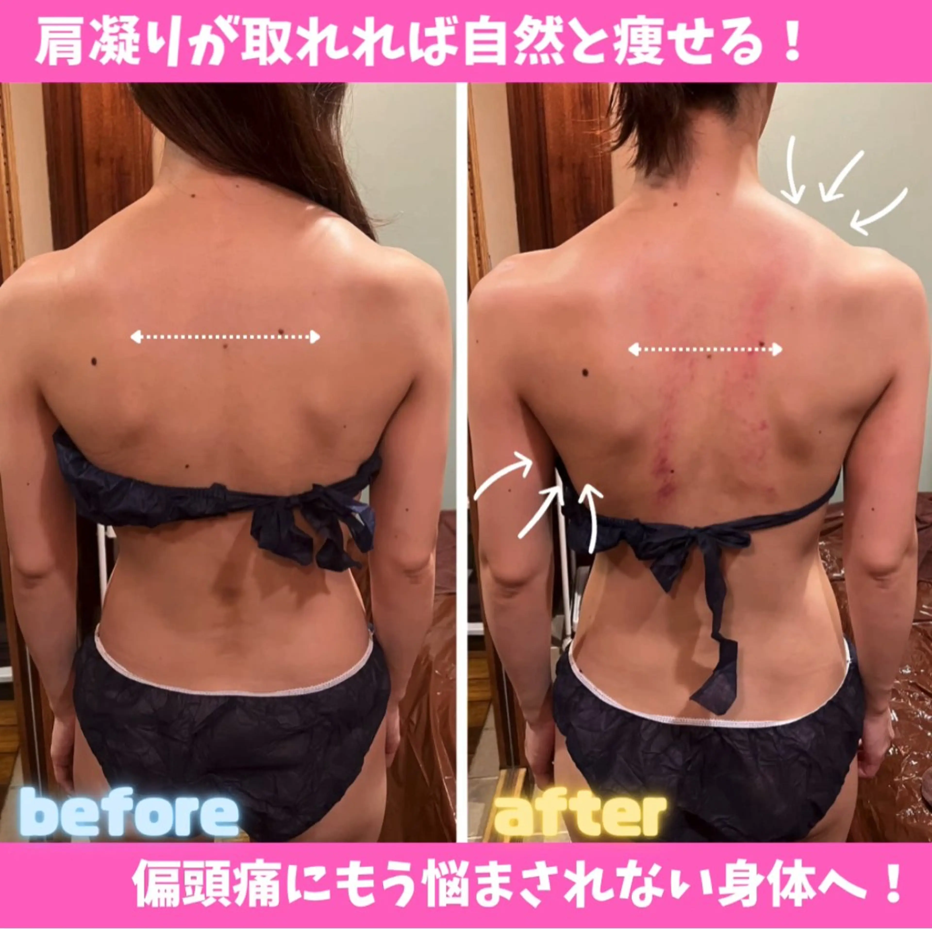 エステ リラク 痩身&美肌サロン 堀米✨のその他イメージ