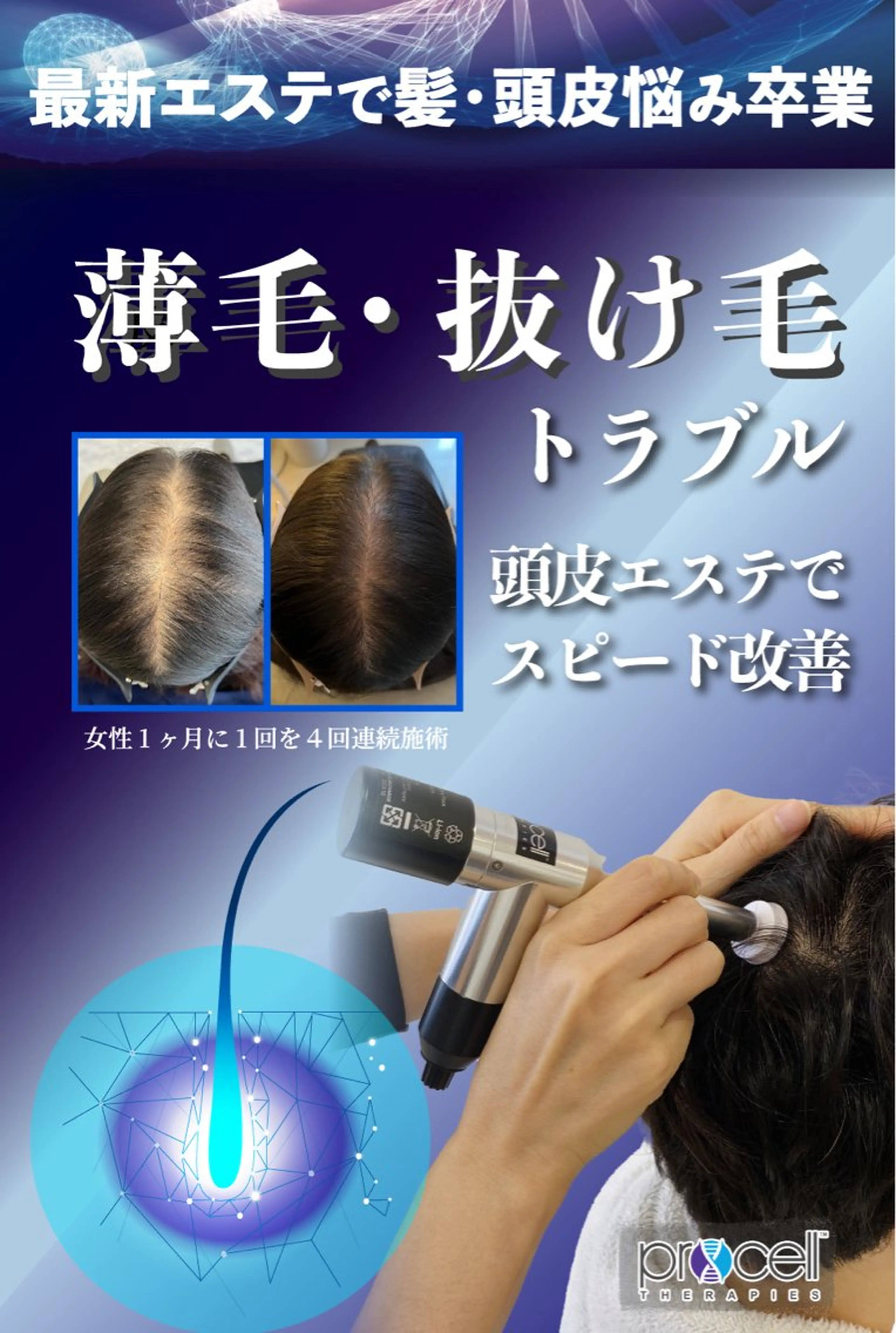 ラシュシュ 茨木のエステ・リラクイメージ