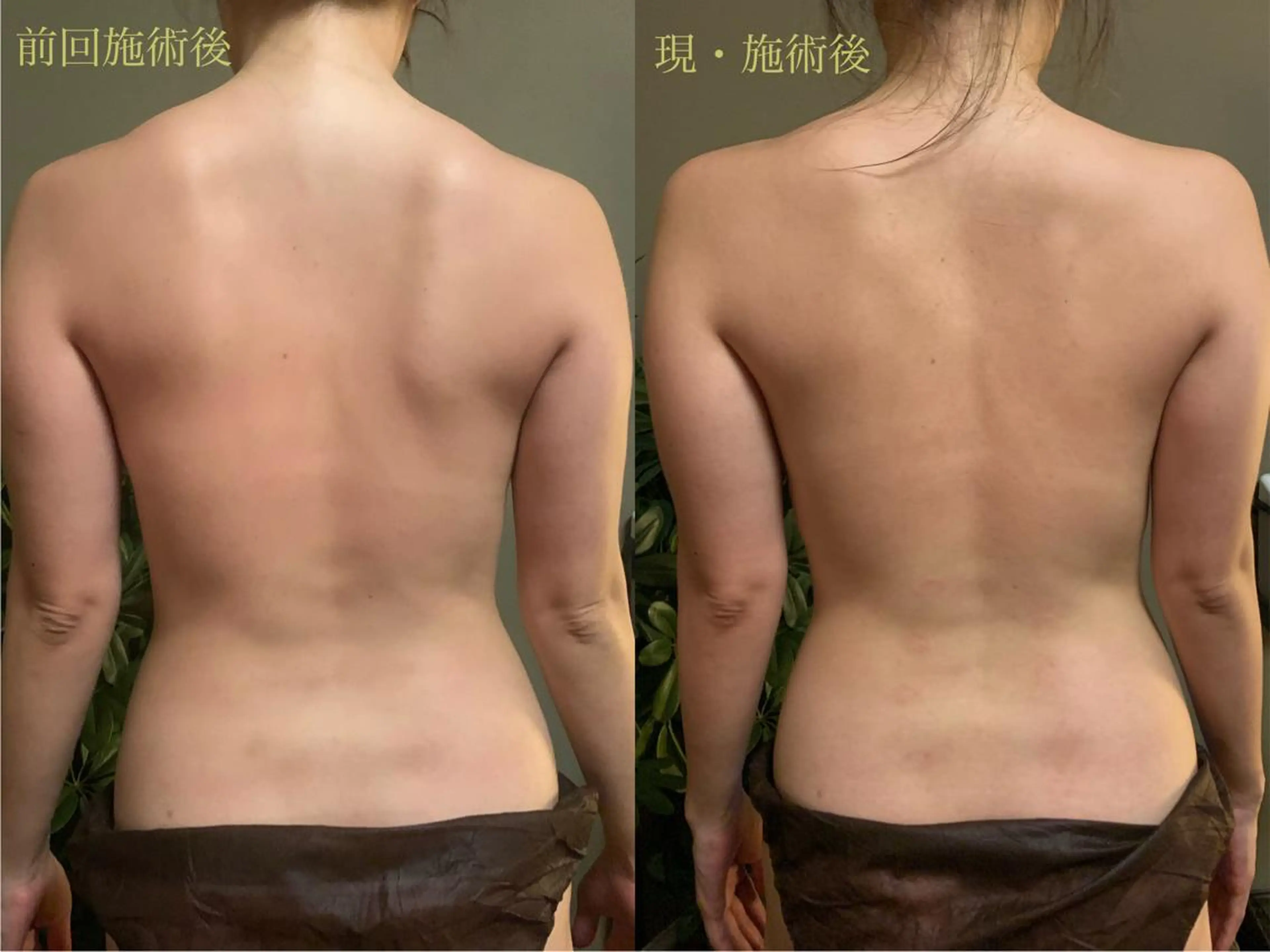 lymph care 'Welnəsのエステ・リラクイメージ