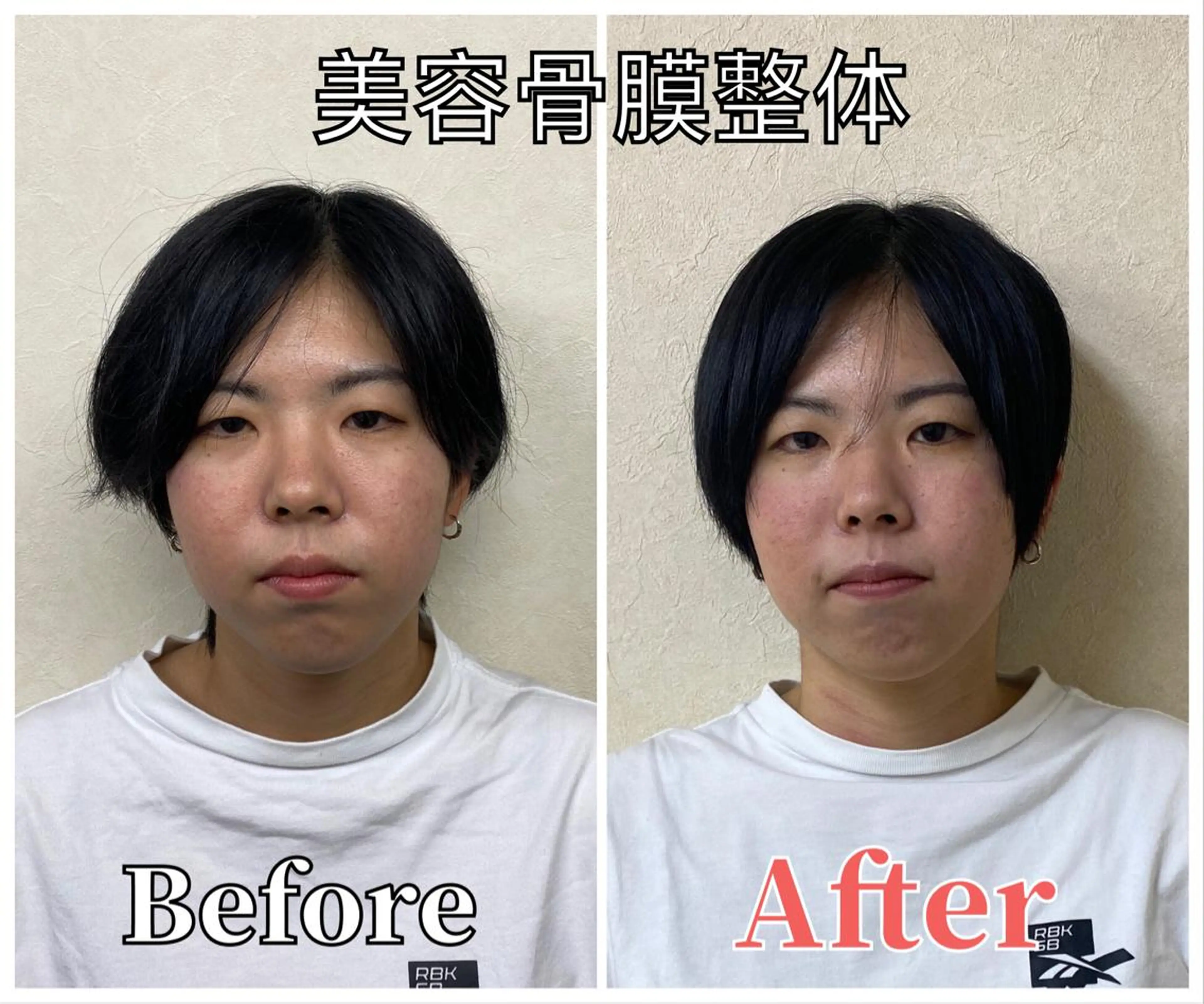 整体 LALUZ中目黒のその他イメージ