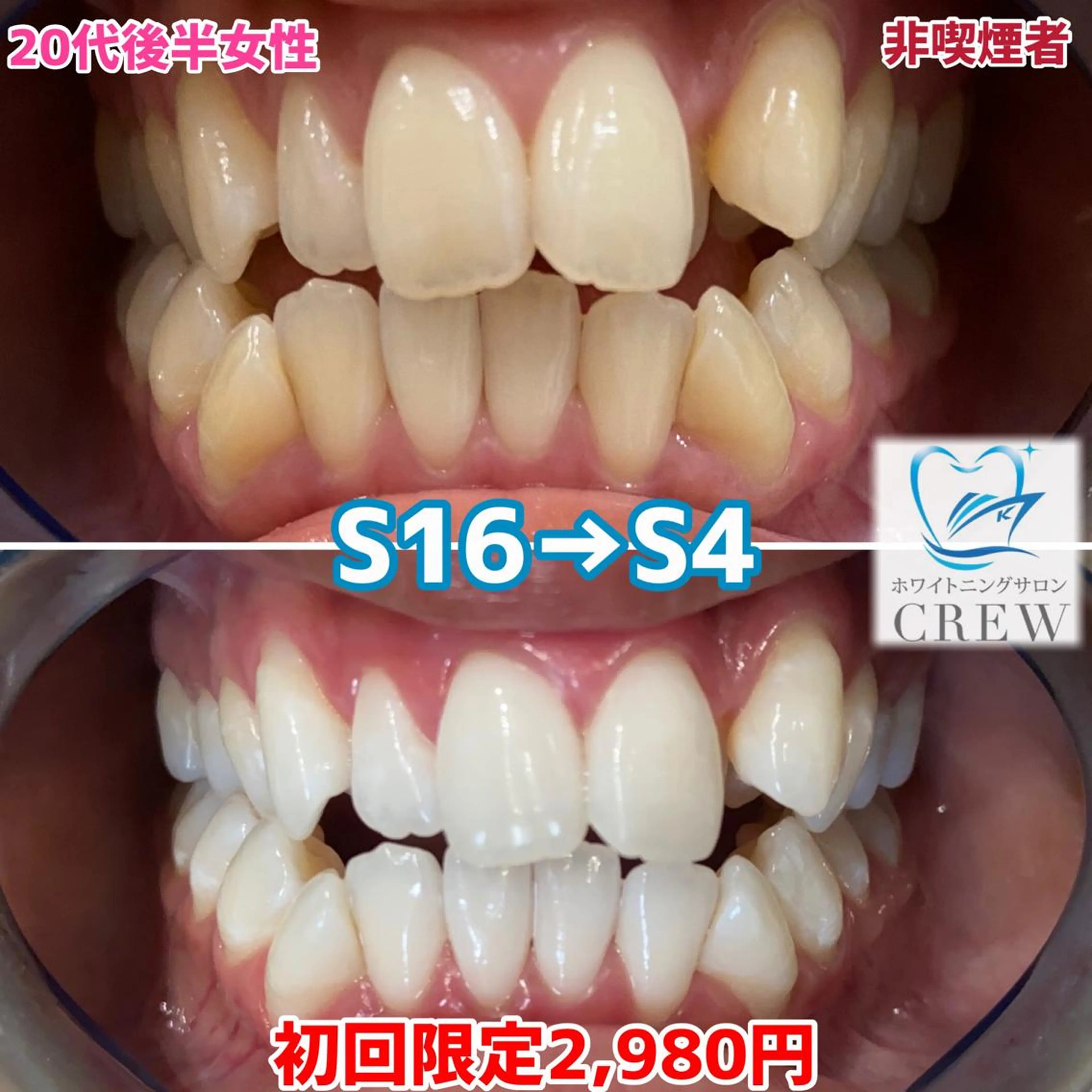 その他 ホワイトニングサロン CREWのその他イメージ